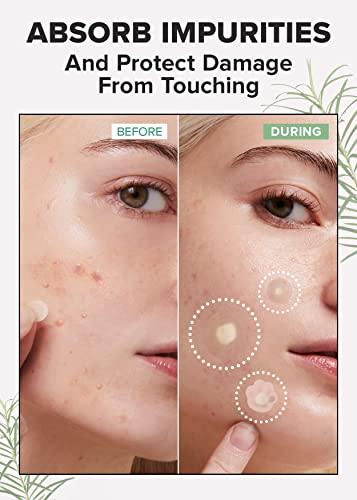 I DEW CARE I DEW CARE Facial Skin Care Set - Meet Your Patch & Proper Popper & Headband | Cute Pimple Patches, Treatment, Clear and Soothe Irritation