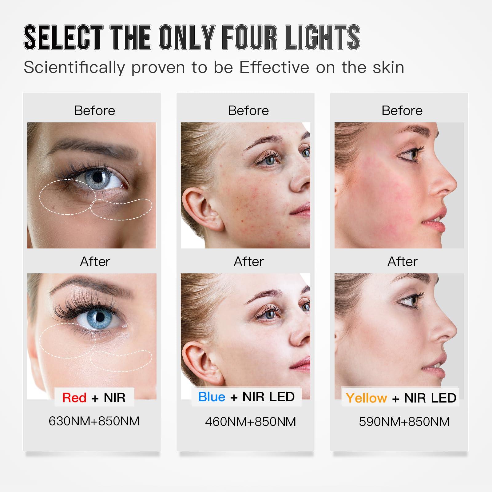 POCHENNAI POCHENNAI Infrared Red Light Therapy Mask, Led Face Mask Light Therapy, Red Light Therapy For Face, At Home Led Mask Therapy Facial, Portable Red Light Therapy for Face, Facial Led Mask Skin(White)