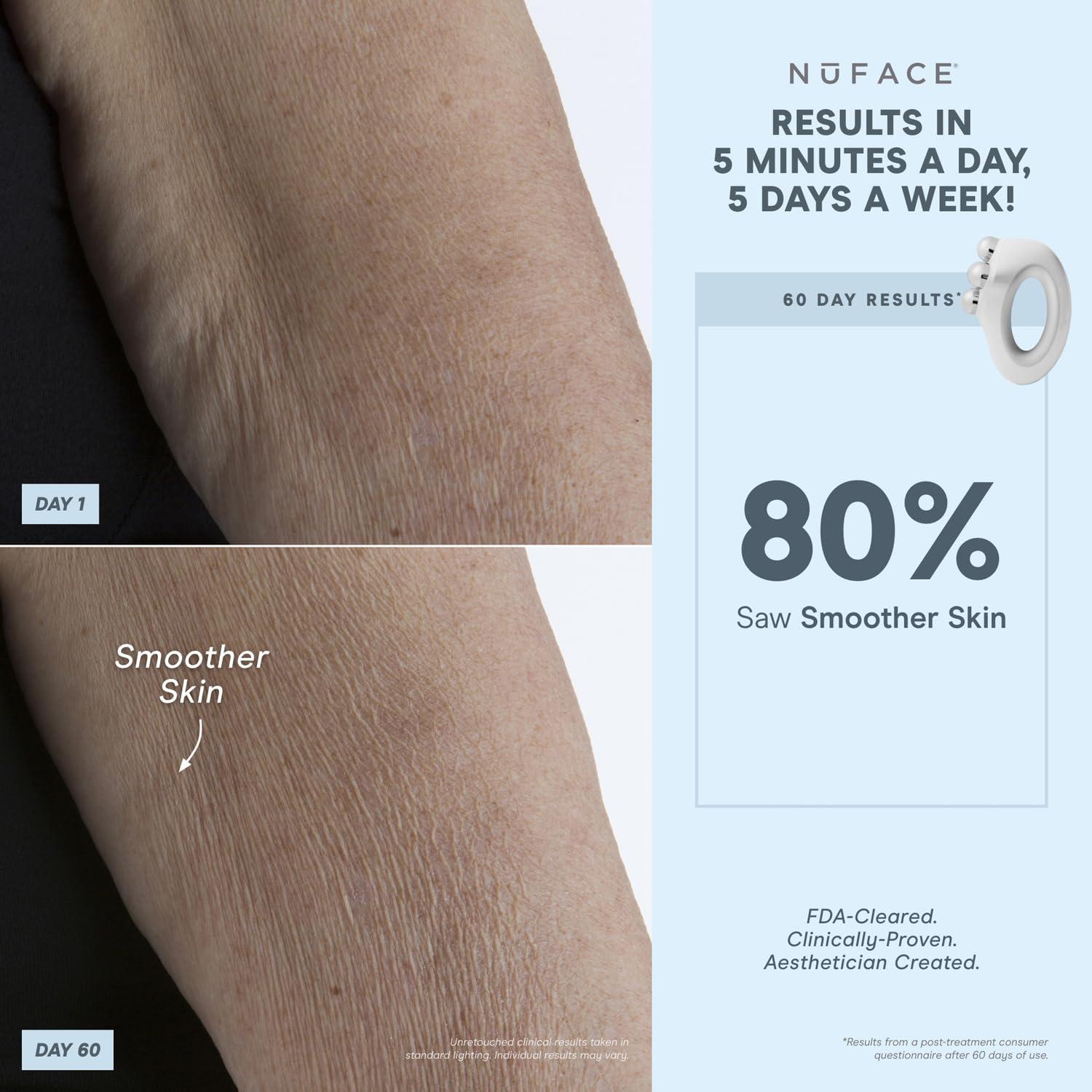 NuFACE NuFACE NuBODY Toning Device - FDA Cleared Microcurrent Device for All-Over Contouring, Firming & Skin Tightening