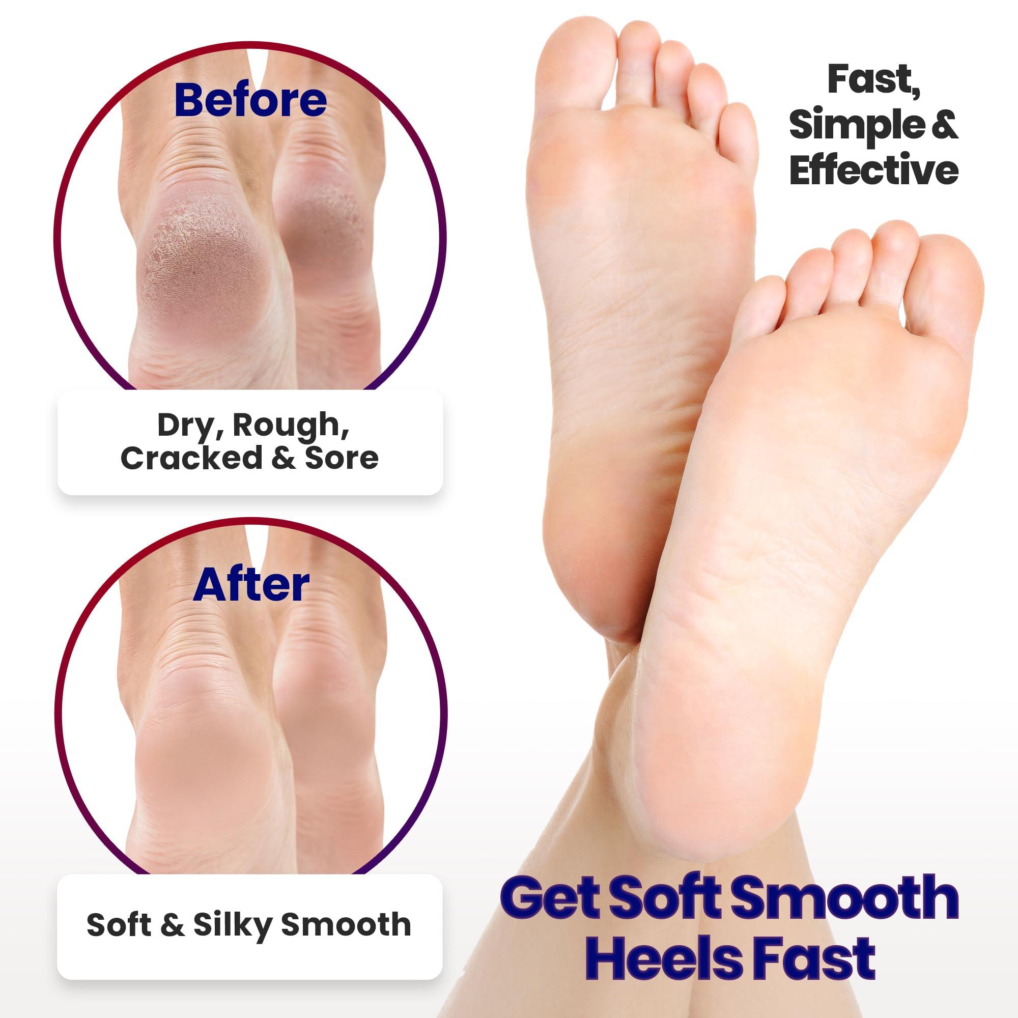 ARMSTRONG AMERIKA Moisturizing Socks for Women & Men | Aloe Vera Cracked Heel Treatment | Foot Callus Remover | Aloe Socks for Cracked Heels & Dry Cracked Feet | Lotion Infused Gel Heel Socks (Large - 3 Pairs)
