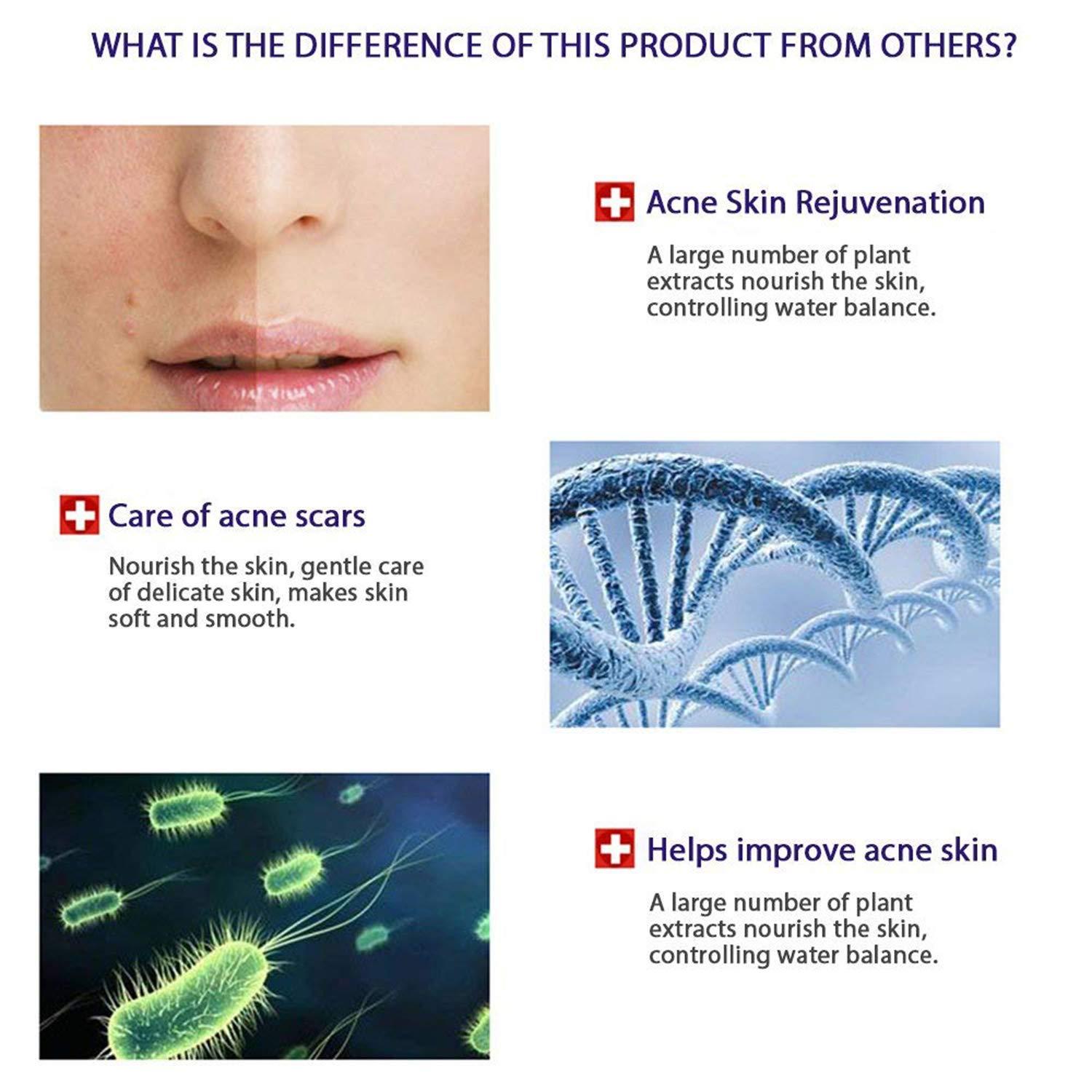 BIOAQUA BIOAQUA Face Skin Care Acne Anti-Wrinkle Removal Cream Spots Scar Blemish Marks 100g