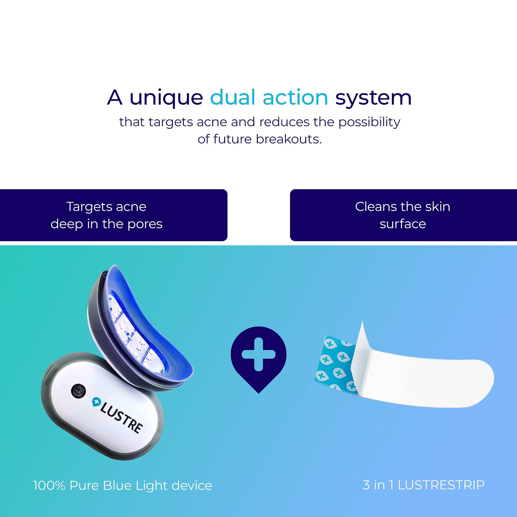 Lustre ClearSkin LUSTRE ClearSkin Solo - Blue Light Acne Treatment Device, UV-Free & Wireless | LED Therapy for Face and Body Acne, Spots and Blemishes |