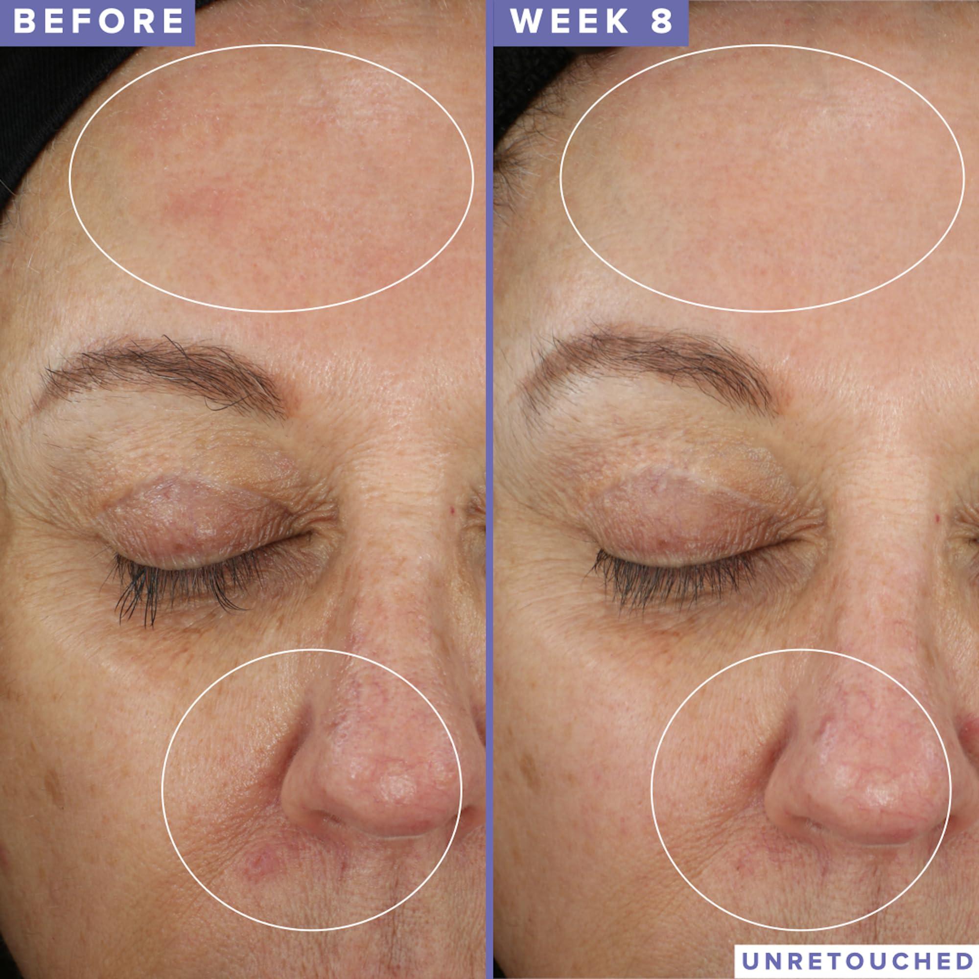 Farmacy Farmacy Niacinamide Overnight Face Mask - Pore Refining Facial Mask with 10% Niacinamide - Replenishes Moisture Barrier with 3% Panthenol + Blueberry Seed Oil for Soft, Supple Skin (9ml)