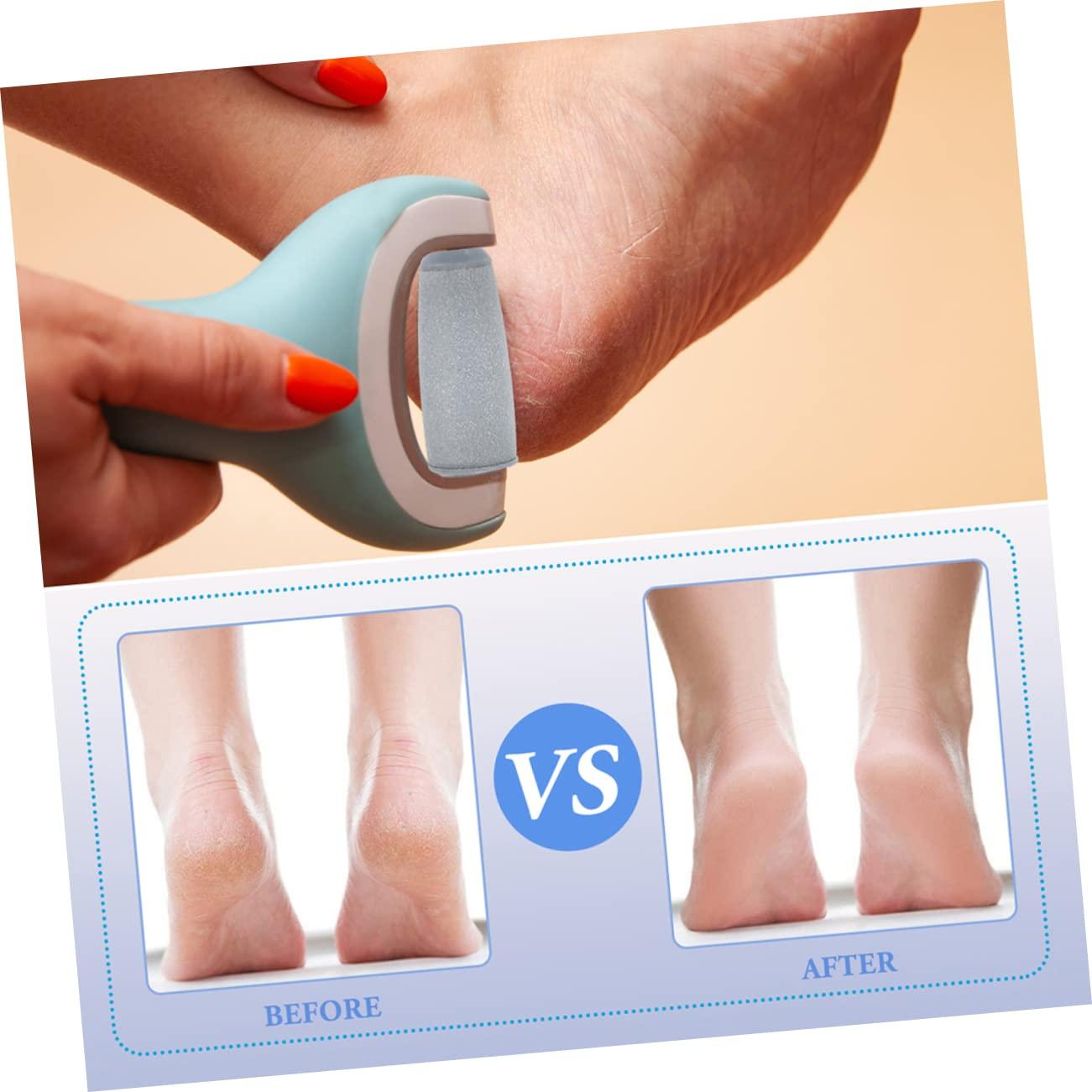 FRCOLOR FRCOLOR 6pcs Foot Grinder Replacement Head Foot Remover Electric Foot Scrubber Dead Skin Remover Foot Grinder Refills Machine Repair Removal Cuticle Walker Foot File Rollers Plastic