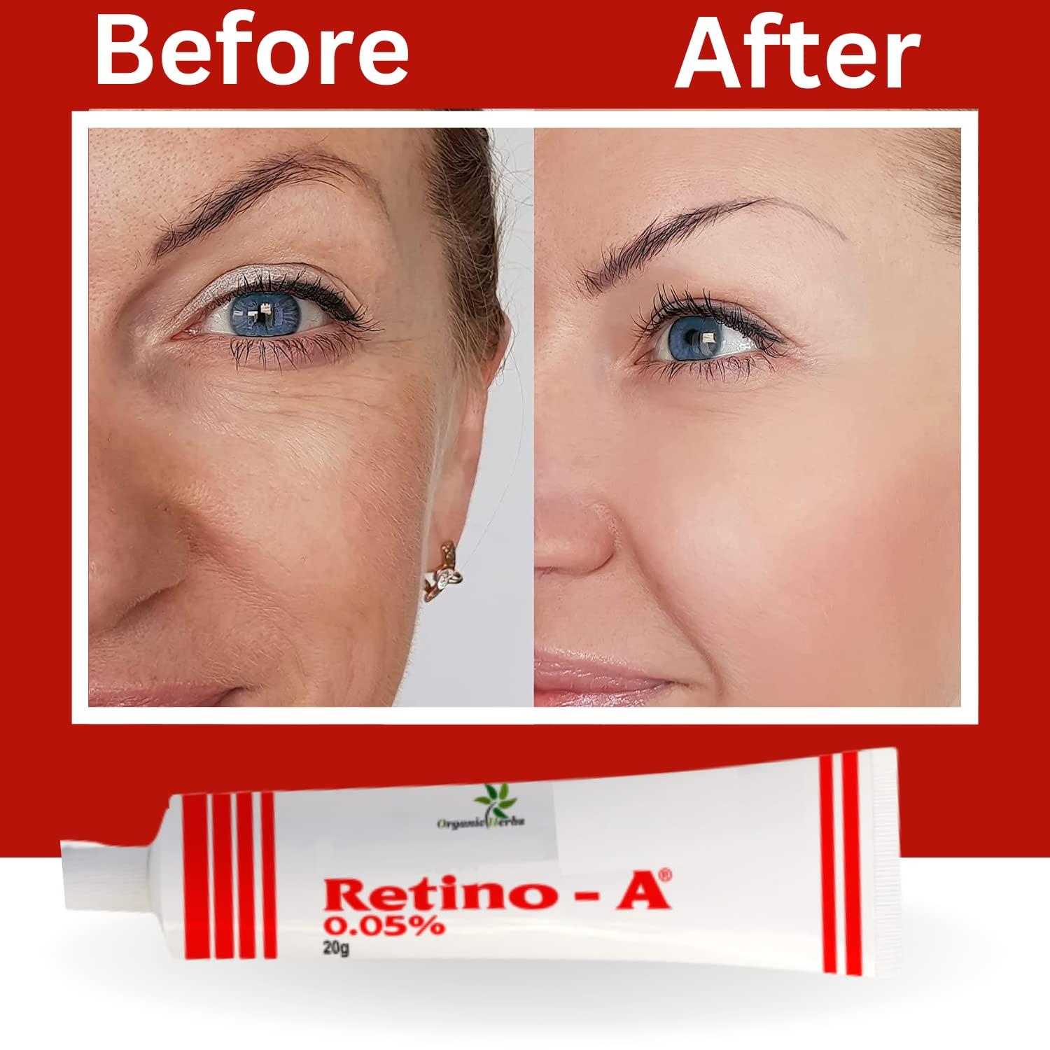 Buycrafty Retinol Night Moisturizer Cream 0.05% Jojoba Oil, Tea Extract, Vitamin E Firming Cream I Anti Aging, Retinol Moisturizer & Wrinkle Cream for Women, Anti Wrinkle Face 20g