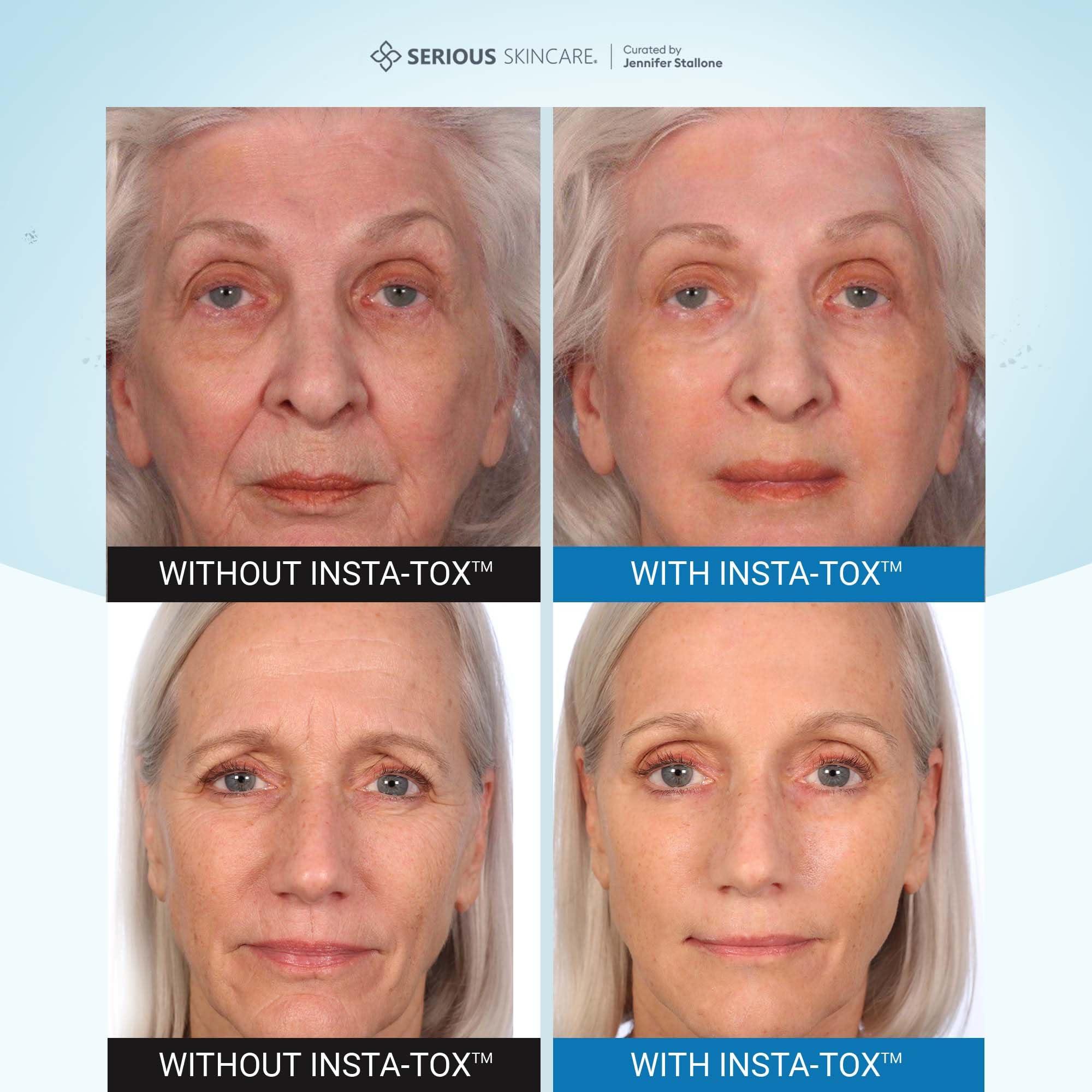 Serious Skincare Serious Skincare - INSTA-TOX Instant Line and Wrinkle Filler Face Serum - Firm and Smooth the Look of Fine Lines, Deep Wrinkles and Pores - Temporary Skin Tightener - .75 oz