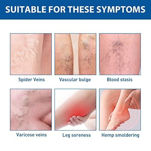 Nosbei Vericose Veins Treatment Blue Light Lazer Treatment Pen, Varicose Veins Blue Light Therapy Set, Blue Light Therapy Pen for Varicose and Spider Veins, Spider Vein Removal Lazer Pen (2cream+1pen)
