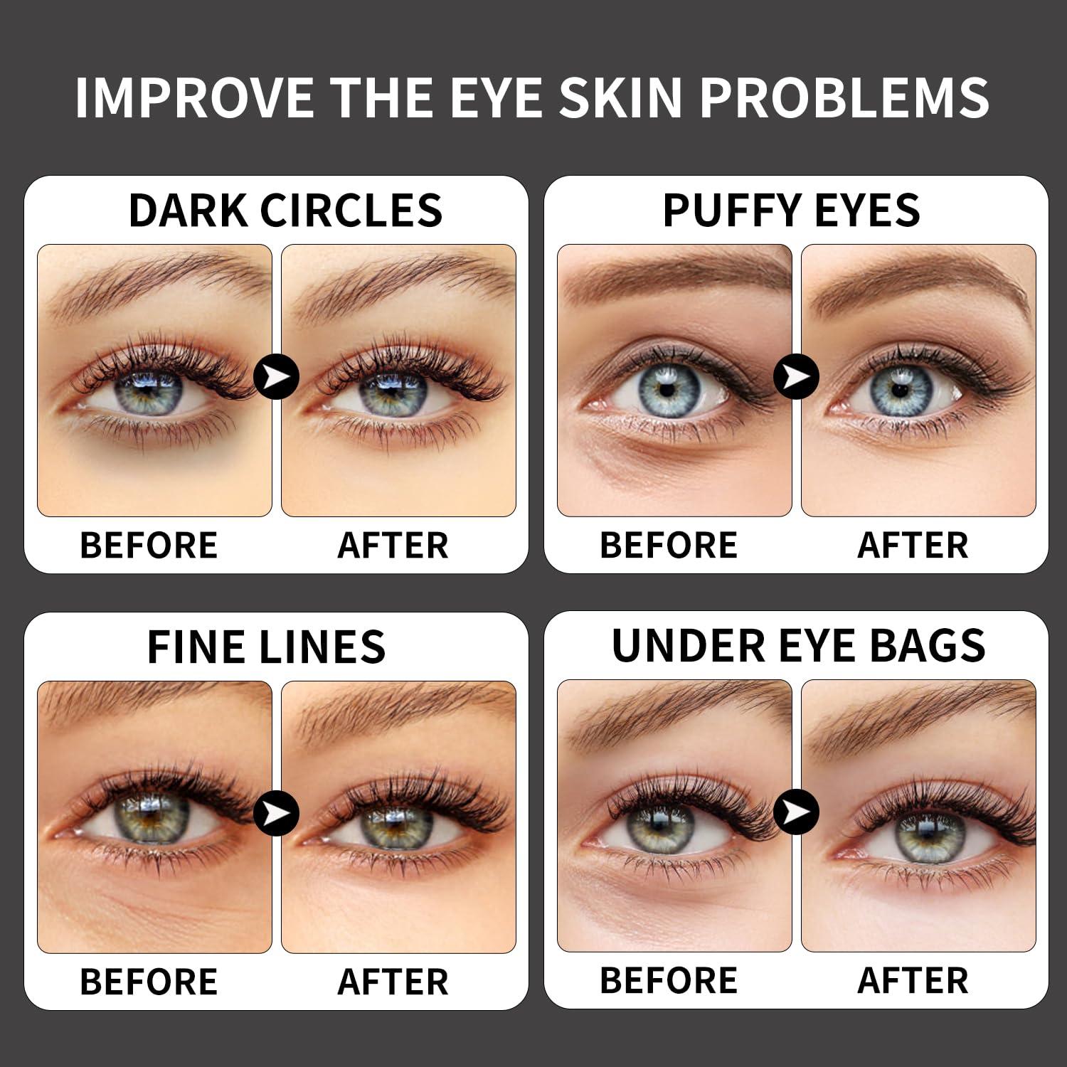 ROUSE ROUSE Collagen Under Eye Patches with Caffeine Eye Treatment Mask for Dark Circles Eye Fatigue Puffiness Refreshing Revitalizing Skin Care Eye Gel Pads-20 Pairs