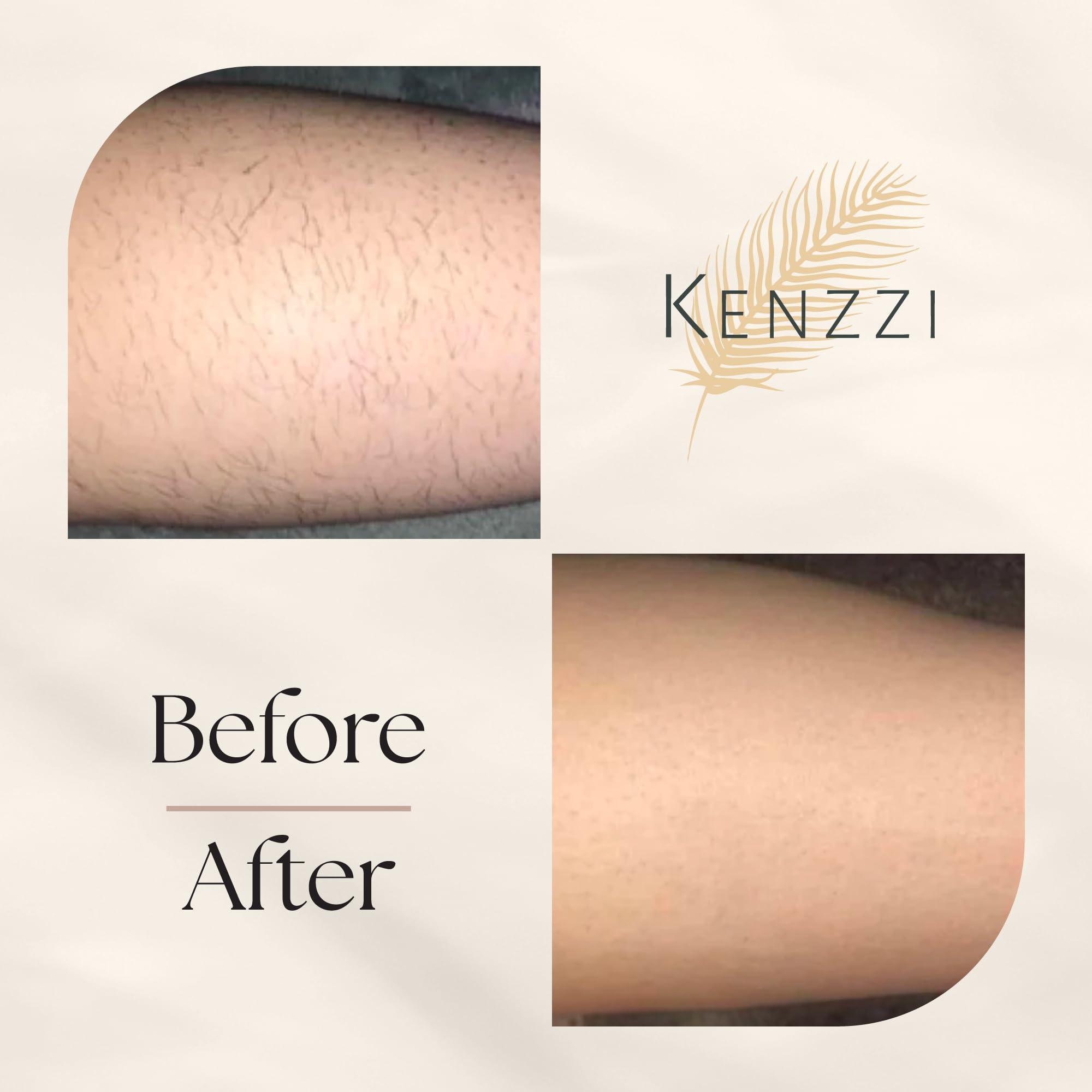 KENZZI Kenzzi IPL Hair Removal Handset for Women & Men: Pain-Free & Long-lasting Solution for Body & Face Hair Removal, An Alternative to Salon Laser Hair Removal Treatments, Permanent Results