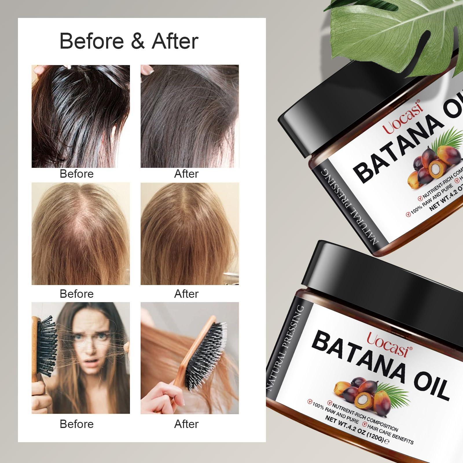 A r b c r n Raw Batana Oil for Hair Growth (4.2 OZ), 100% Pure Natural Unrefined - Prevent Hair Loss and Promotes thickness for Women & Men