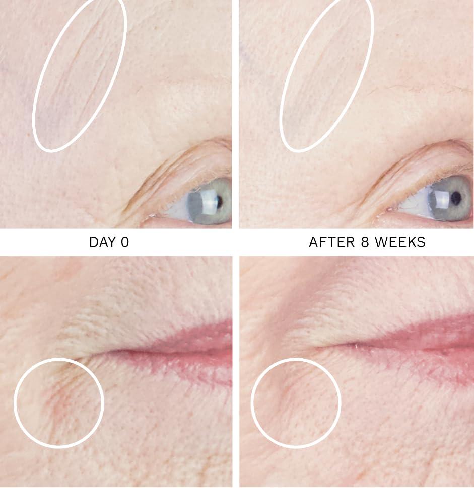 City Beauty City Beauty UpLift Firming Serum - Face Serum - Lift & Tighten - Natural Sagging Skin Solution with Deep-Sea Extracts - Visibly Smooth Fine Lines & Wrinkles - - Cruelty-Free Skin Care