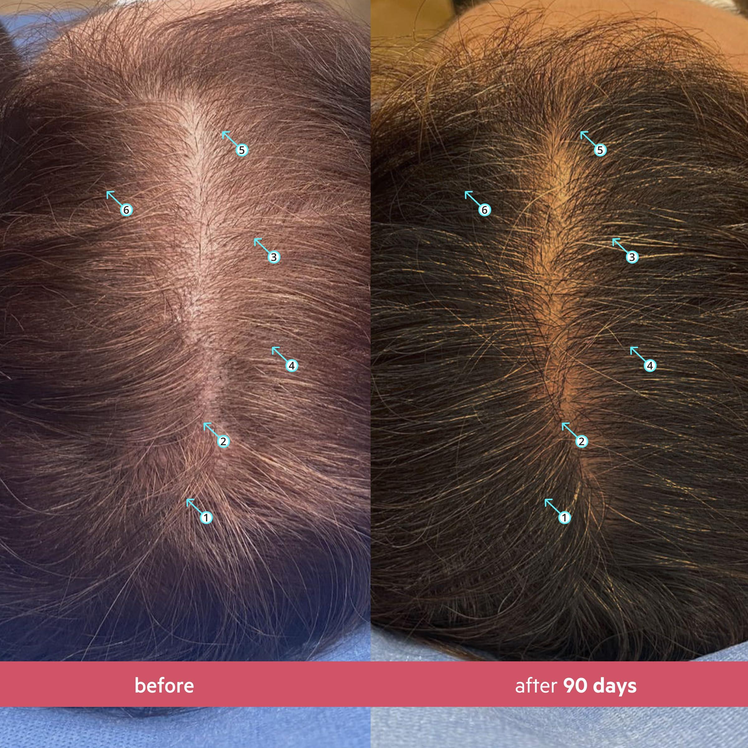 DS Laboratories DS Labs Spectral Women's Formally Spectral.CSF - Hair Density Serum for Women, Thickening, Strengthening, Volumizing, Fuller-Looking Hair, 60mL, Packaging May Vary