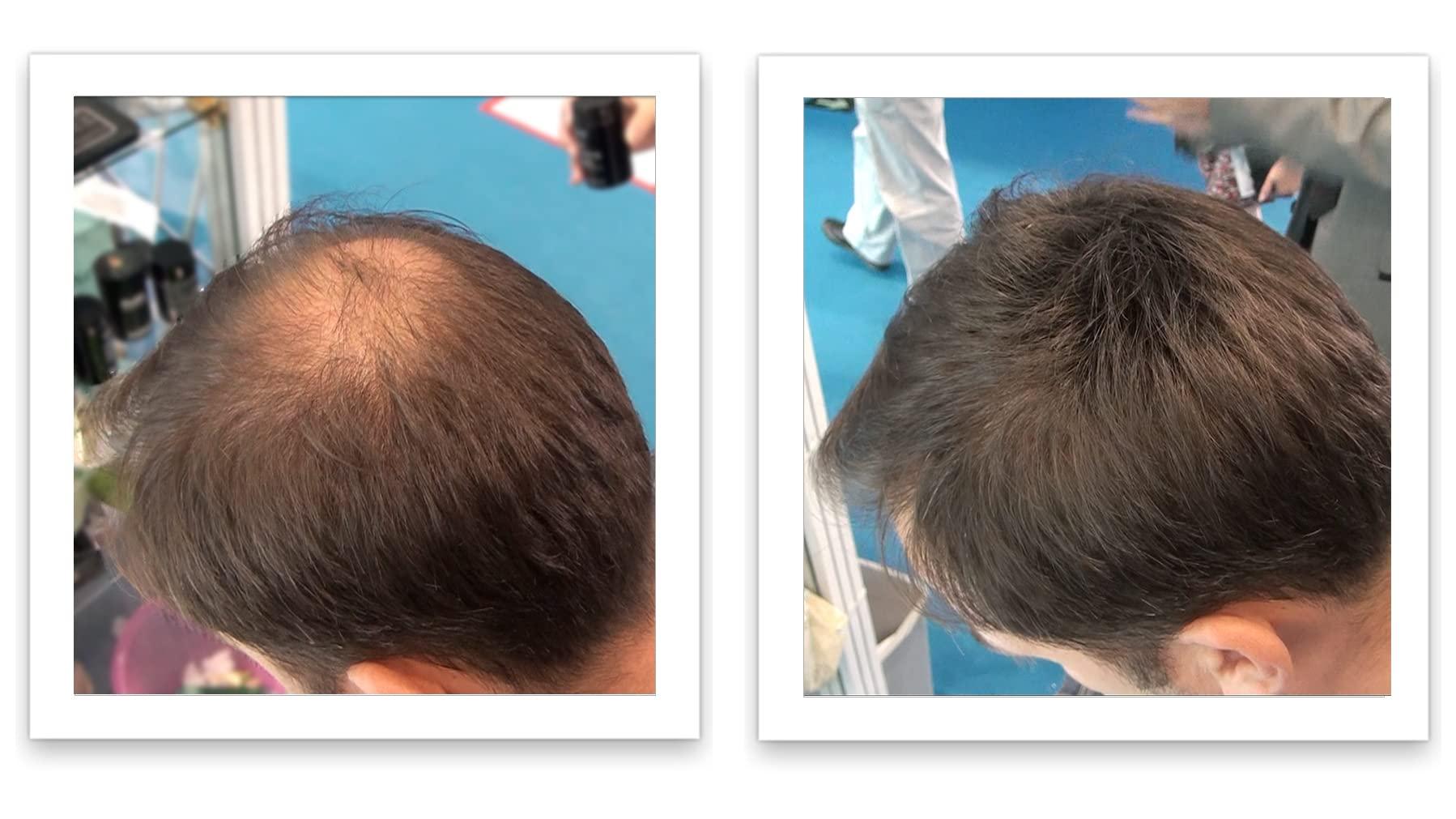 Caboki Caboki Hair Loss Concealer (All-Natural Hair Building Fibers) Travel Size (Medium Brown)