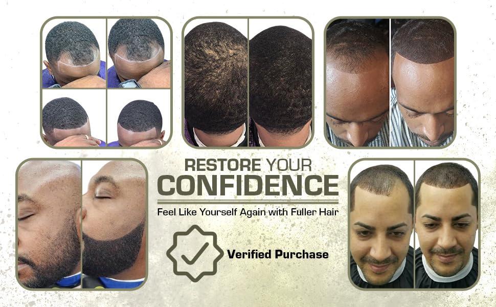 Hair Fusion Hair Fibers for Thinning Hair - (1.05 Oz) Real Human Hair Building Fibers to Conceal Bald Spots and Thinning Hair, Root Touch Up and Volumizer, Black