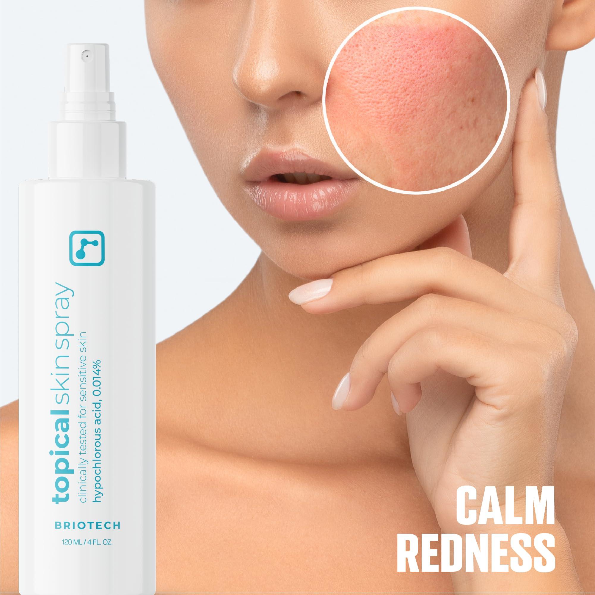 BRIOTECH BRIOTECH Topical Skin Spray, Hypochlorous Acid Spray for Body & Face, Eyelid Cleanser, HOCl Facial Mist, Support Against Irritation, Calm Redness, Soothe Scalp, Packaging May Vary, 4 oz ea, 2 ct