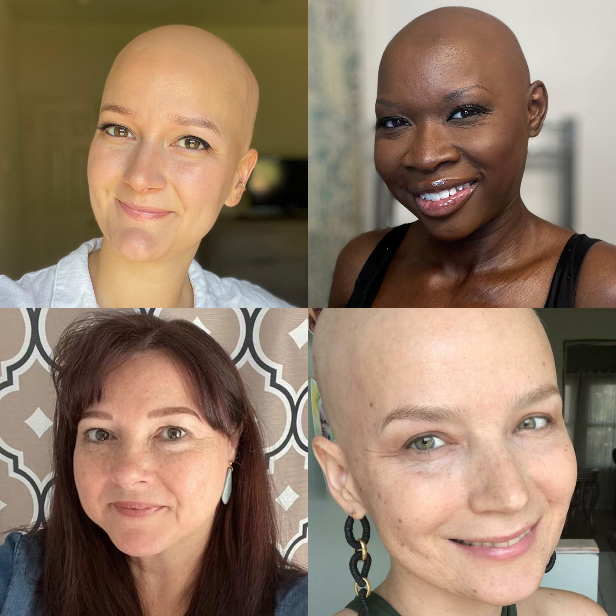 ZhouBoat ZhouBoat 32 Pack 5 oz Plastic Jars with Gold Lids, Clear Empty Body Butter Containers Travel Size Cosmetic Bottles for Make Up and Food Storage