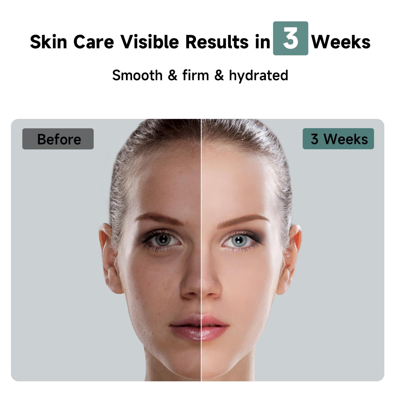 JOVS JOVS Laser Hair Removal, 37F Painless Hair Removal Device with Sapphire Ice-Cooling, 3 in 1 Hair Removal & Skin Rejuvenation for Women and Men, 8 Modes Skin Care for Whole Body, Touch Screen