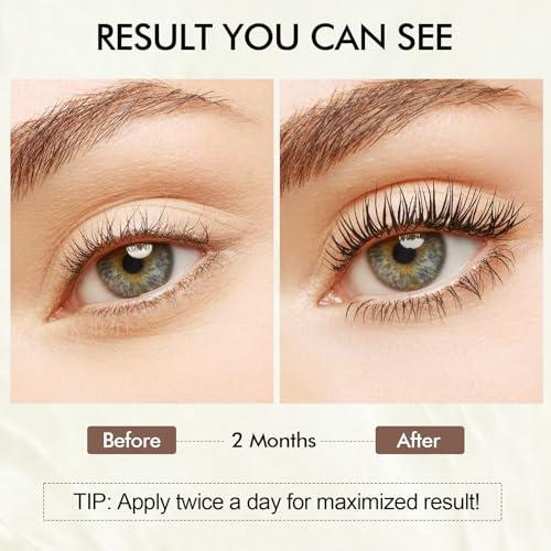 Simpout Simpout Eyelash Growth Serum - Fuller & Longer Looking Eyelashes Lash Enhancing Serum, Voluminous Lengthening Natural Lash Enhancer, Vegan & Cruelty-Free (Silver)