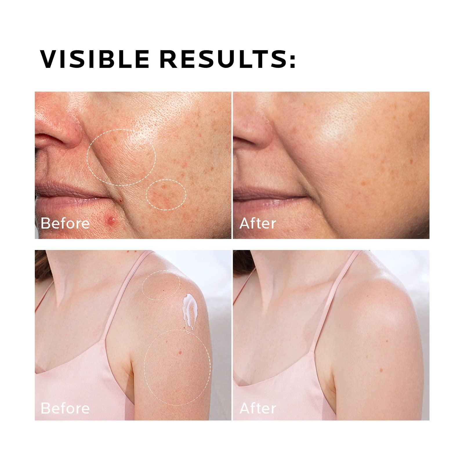 ZealSea ZealSea Face Moisturiser Lotion with Hyaluronic Acid & Ceramide & Aloe Vera, Hydration Moisturiser for Normal To Dry Sensitive Skin, Facial and Body Hydrating Moisturizing Cream - 290 ml