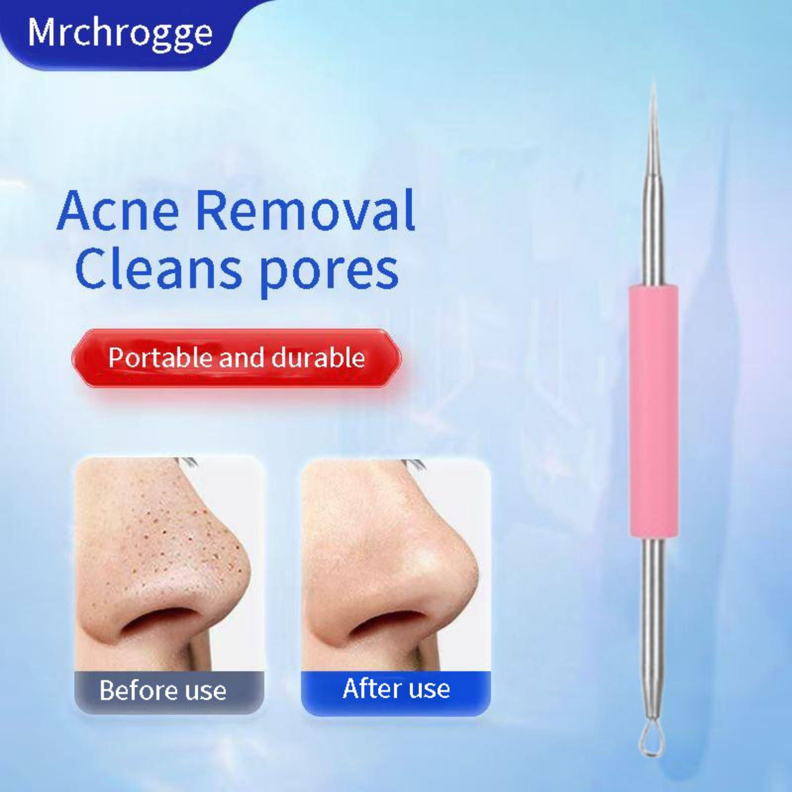 Mrchrogge Mrchrogge Facial Blackhead Remover Tweezers,Stainless Steel Portable Acne Needle Double Head,Squeeze Pick Acne Blackhead Needle Acne Needle Acne Needle (Pink)
