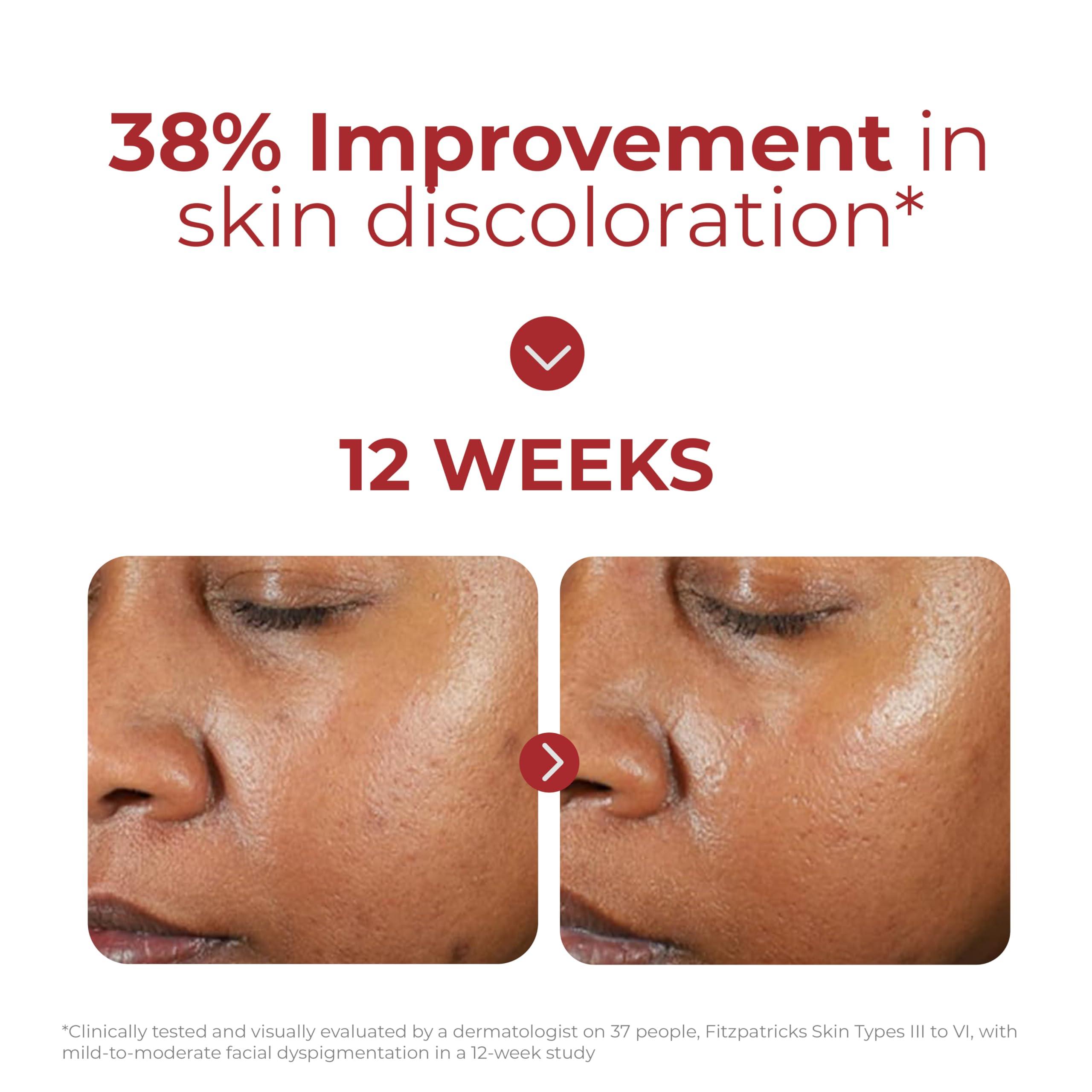 EltaMD EltaMD UV Clear Deep Tinted Sunscreen for Face - Deep Tinted SPF 46 with Zinc Oxide, Oil-Free, Dermatologist Recommended Face Sunscreen, 1.7 oz