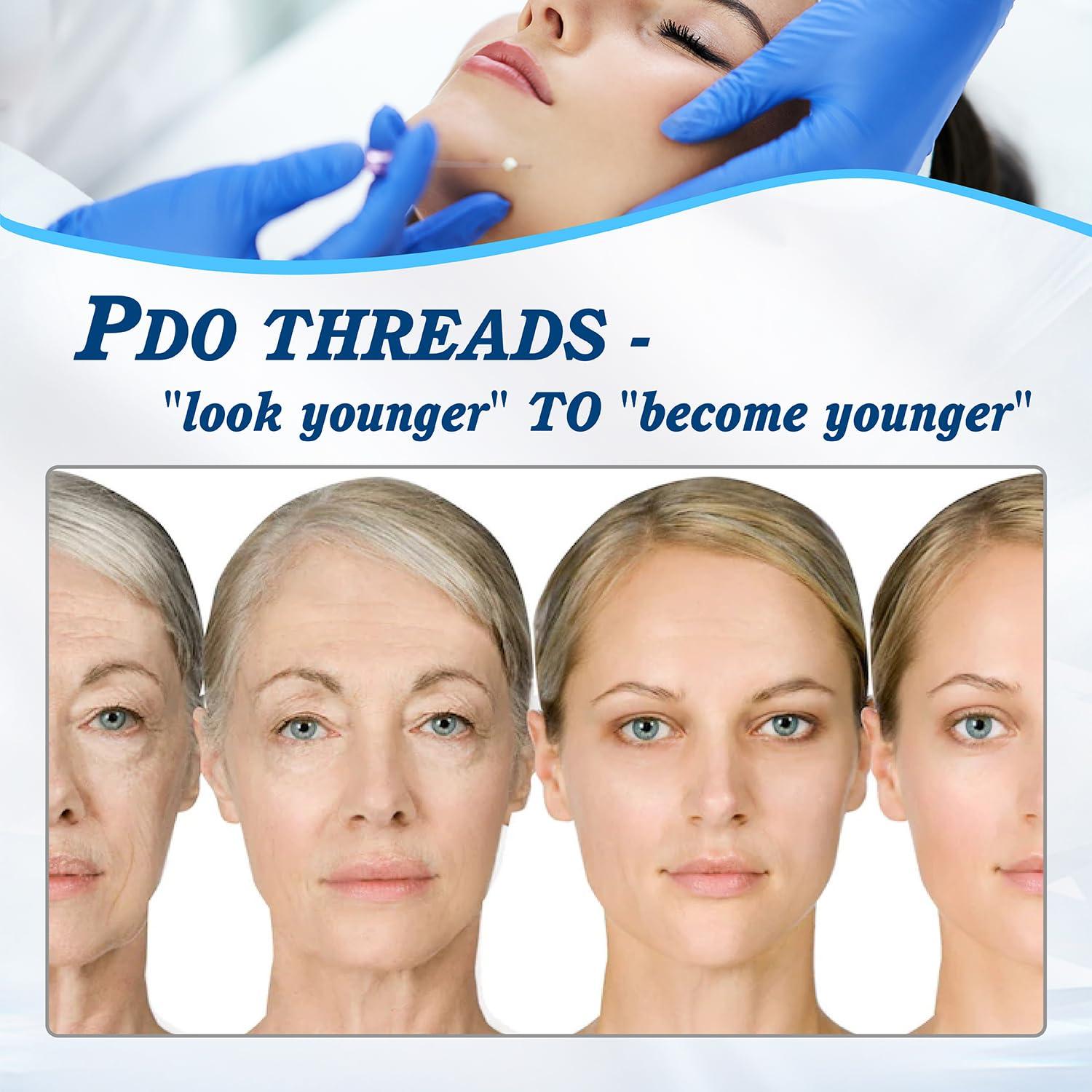 Newliky Pdo Threads for Face Lift Mono Screw Type (29G50MM) Smoothing Wrinkles PDO Thread Lift for Whole Body with Sharp Tip 20pcs