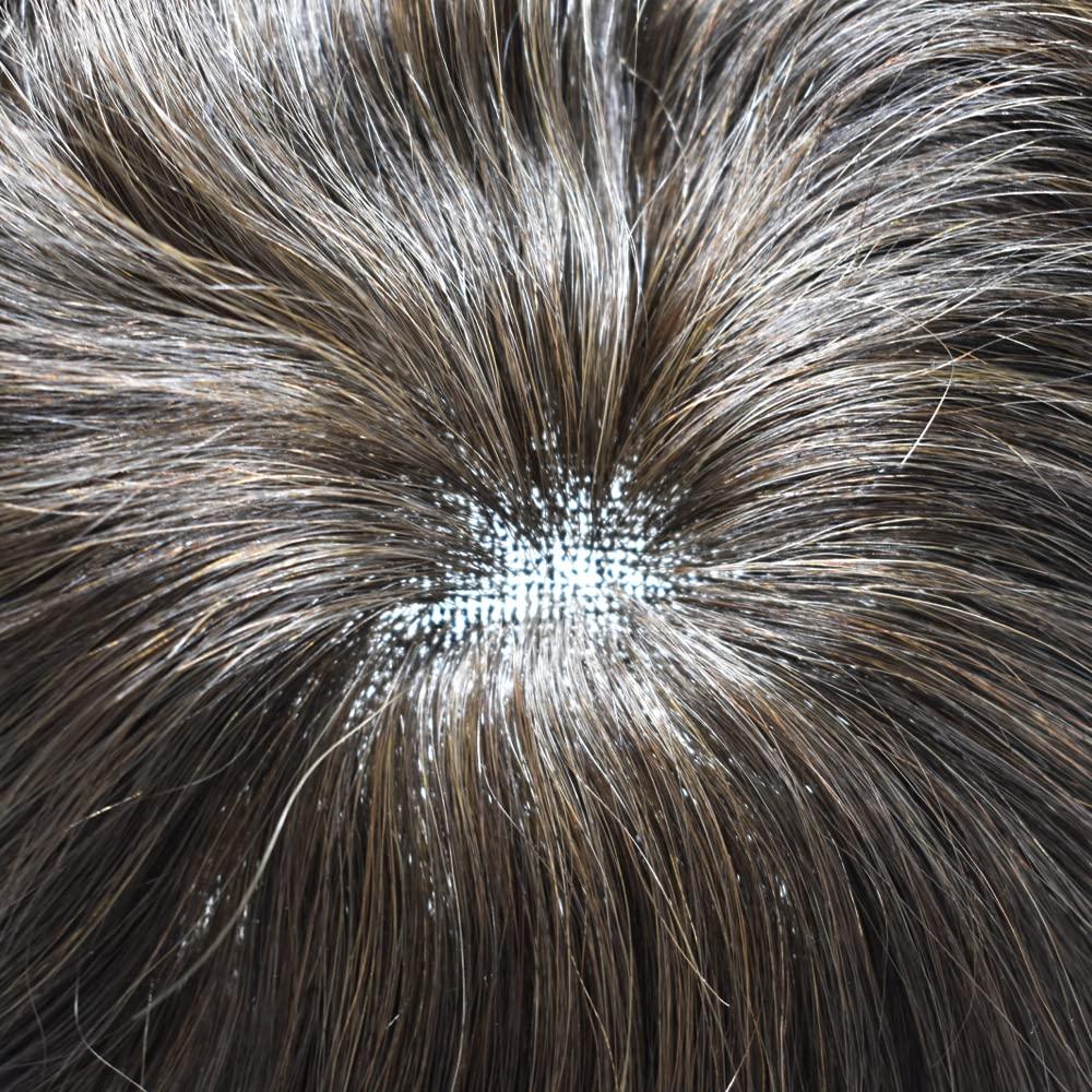 EltaMD EltaMD Clear Skin Daily Duo Sensitive Skin Kit, AM Restore Facial Moisturizer and UV Clear Face Sunscreen Set, Helps Calm Rosacea and Acne Prone Skin, Made with Niacinamide and Zinc Oxide