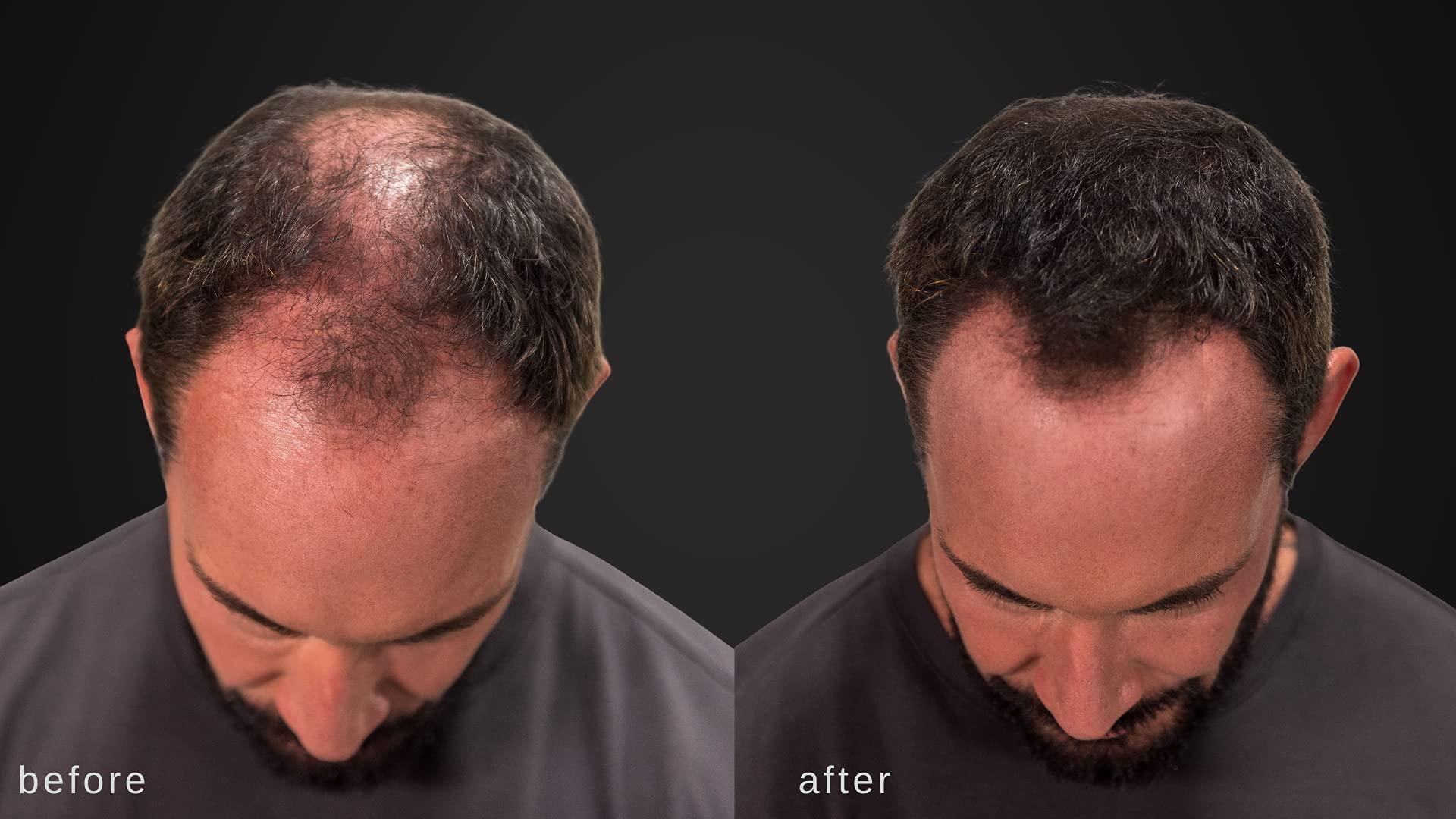 LUXE Professional LUXE Hair Thickening Fibers - CONFIDENCE IN A JAR – 2 Months+ Supply! – Hypoallergenic, Dermatologist Tested – Multiple Colors Available (Dark Brown)