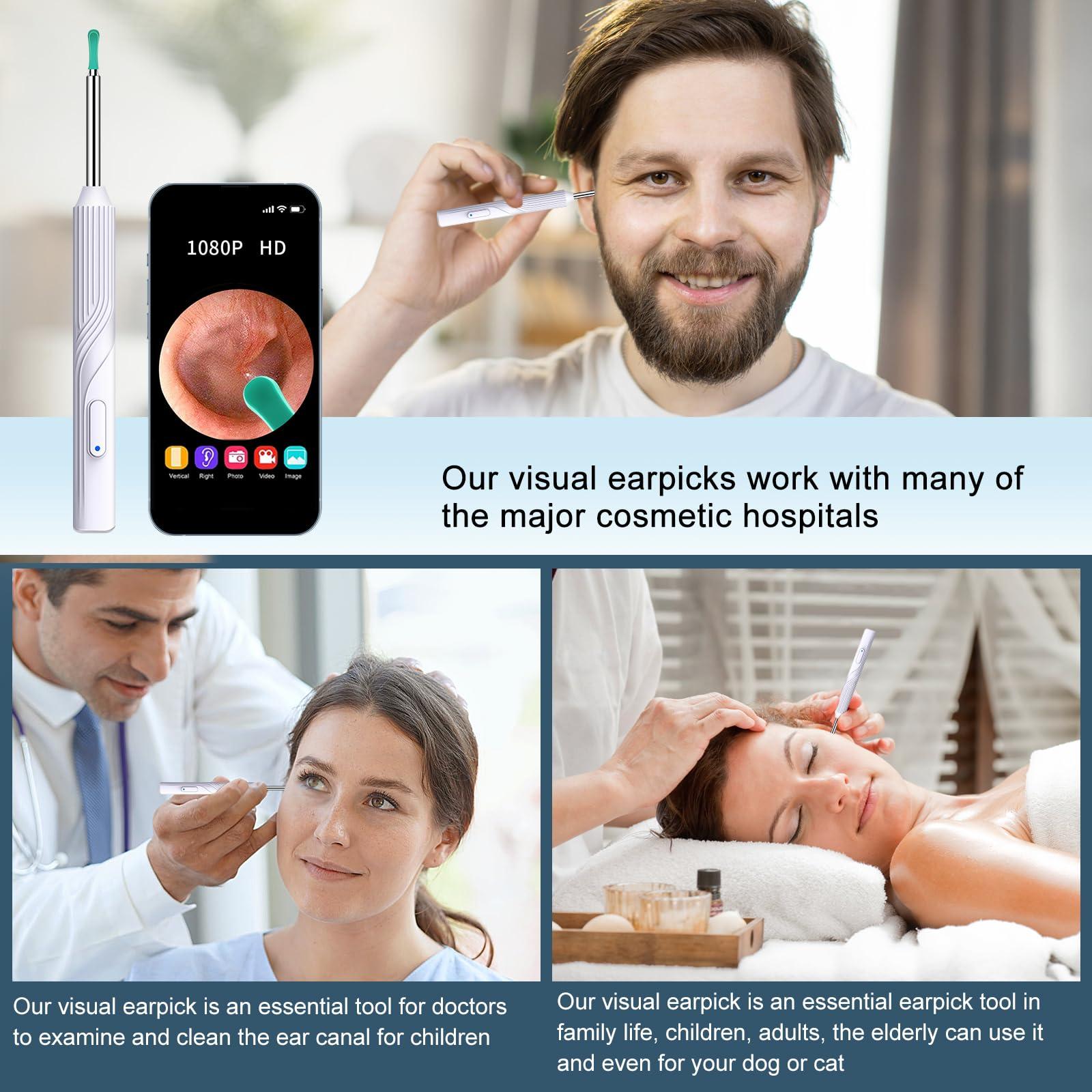 Mapleboom Ear Wax Removal Tool, Ear Cleaner with1080P HD Otoscope Camera, Ear Camera Otoscope with Light, 6 LED Lights, Built-in WiFi,Ear Cleaning Kit for iPhone and Android Phones