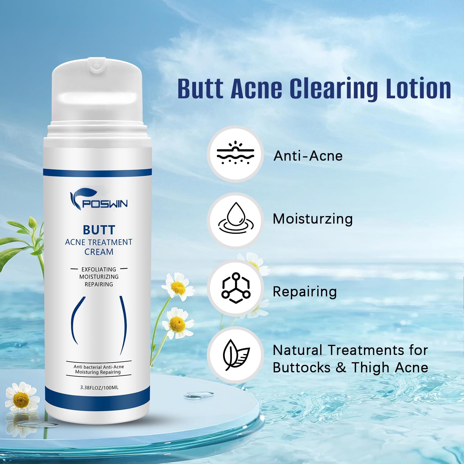 POSWIN POSWIN Butt Acne Clearing Treatment Cream: Acne Clearing Lotion for Butt and Back - Moisturize Cream with Salicylic Acid & Tea Tree Skin Delicate Smooth Body Care for Men Women - 100ML