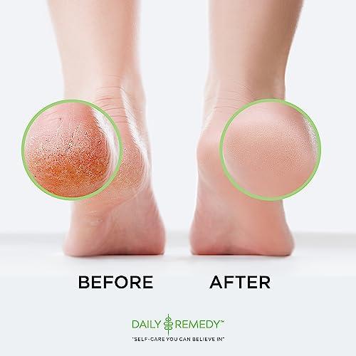 DAILY REMEDY EXTRA STRENGTH Tea Tree Oil Foot Soak with Epsom Salt - Made in USA - for Toenails, Athlete\'s Foot, Itchy Feet, Stubborn Smelly Foot Odor, Pedicure, Foot Calluses & Soothes Sore Tired Achy Feet -16 oz