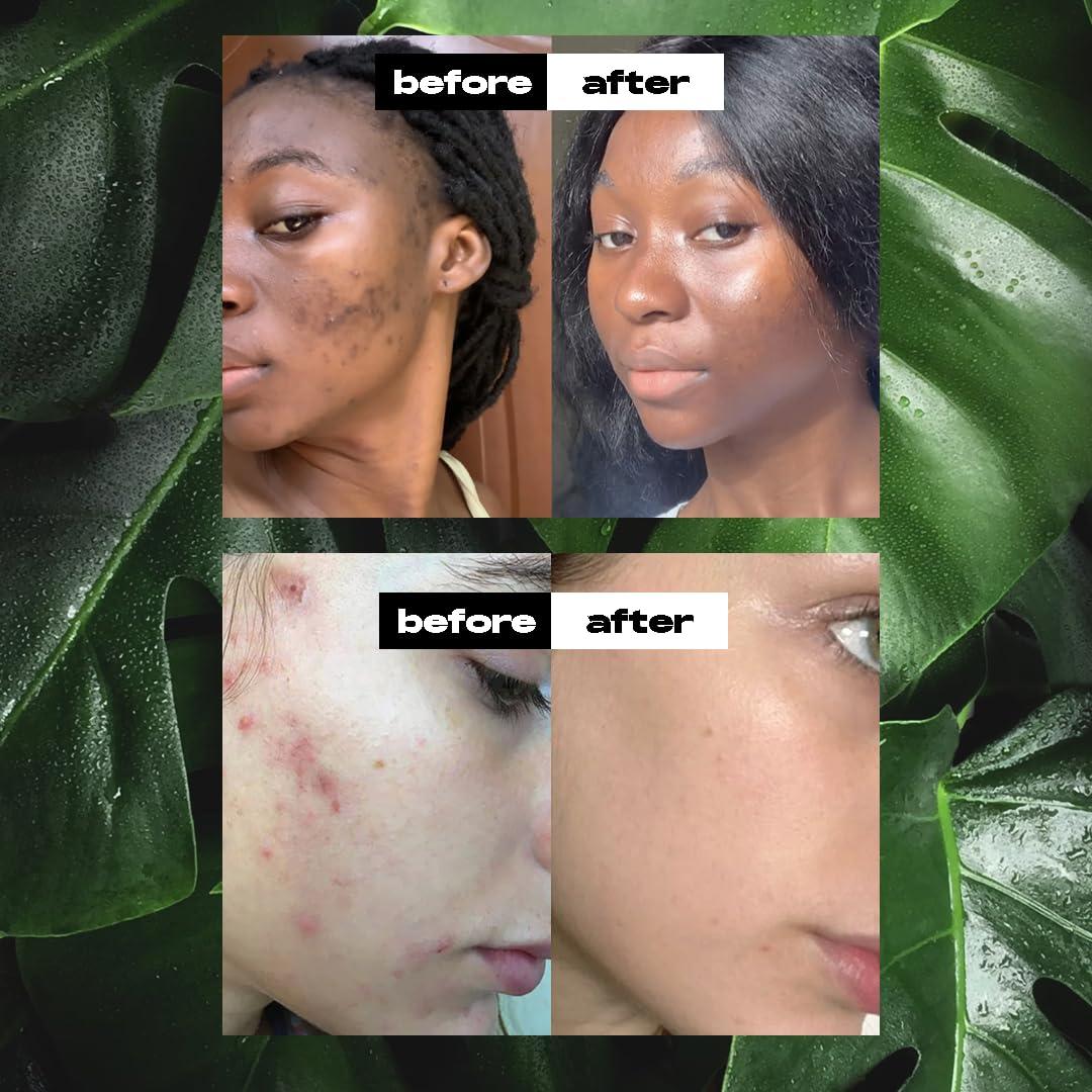 White Naturals Raw African Black Soap 1lb Bar, for Dry Skin and Skin Conditions, Pure & Natural Ingredients, Imported From Ghana