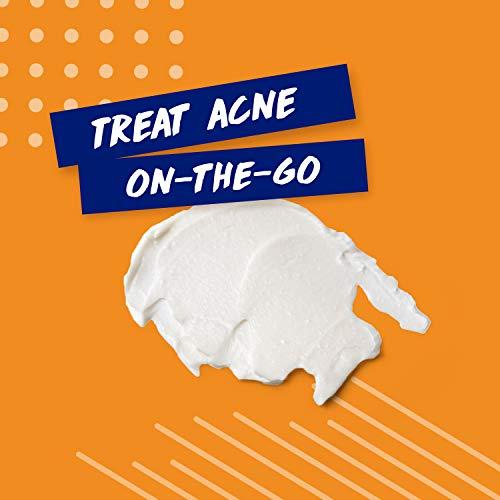 Clearasil Clearasil Stubborn Acne Control 5in1 Spot Treatment Cream, Maximum Strength, Benzoyl Peroxide Acne Medication, Fights Blocked Pores, Pimple Size, Excess Oil, Acne Marks & Blackheads, 1 oz (Pack of 12)