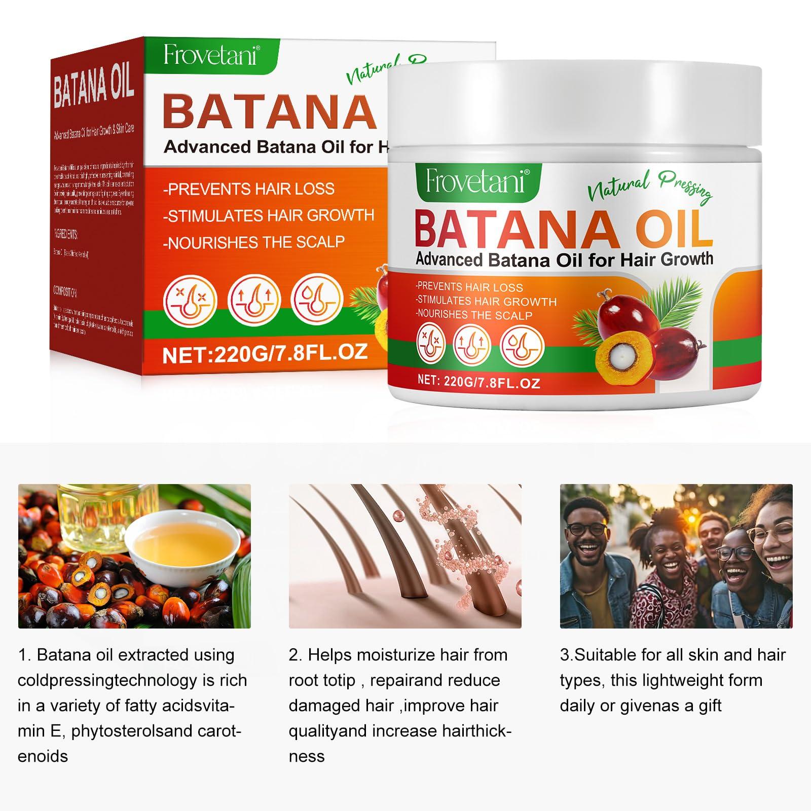 Frovetani Frovetani Batana Oil from Honduras for Hair Growth, 100% Organic Raw , Promotes Hair Thickness, Healthier & Strengthening, Prevents Hair Loss 7.8FL.OZ