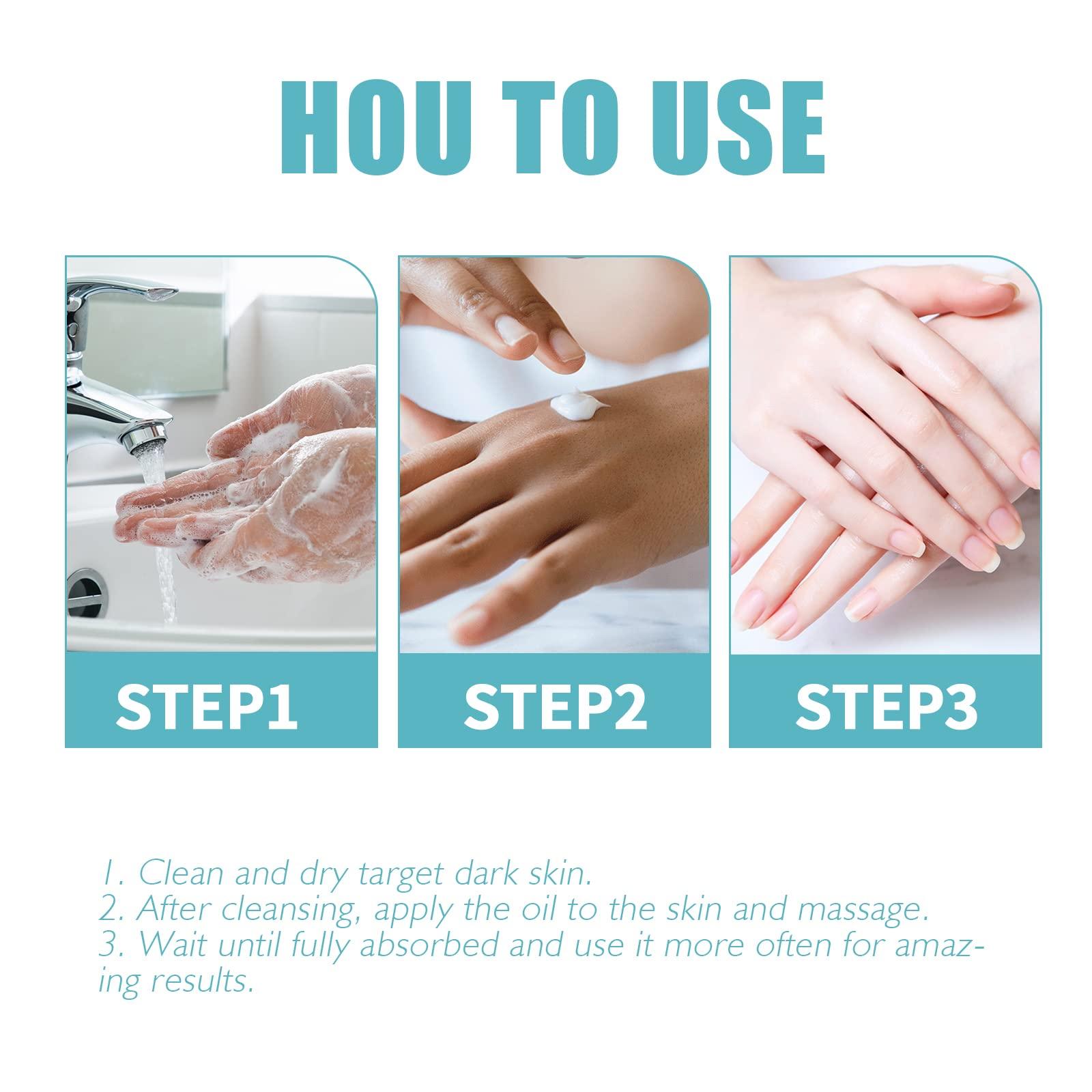 Nigrifix Nigrifix Acanthosis Nigricans Therapy Cream,Dark Spot Remover For Body,Dark Spot Corrector Cream,- Underarm, Neck, Armpit, Knees, Elbows, Private Areas, Intimate Areas - Upgraded Formula, 2.1Fl Oz