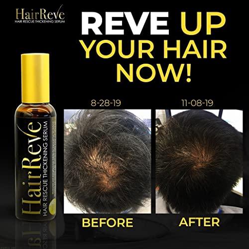 HairReve HairReve Hair Rescue Serum and Shampoo System, Follicle Care for Overall Healthier Hair (Thickening Serum and Shampoo Pack)
