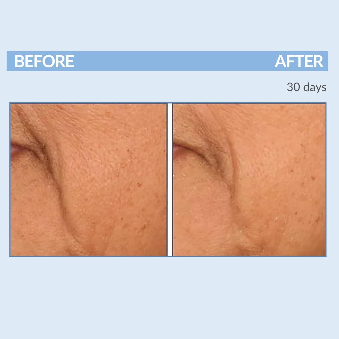 Serious Skincare Serious Skincare Retinol Facial Care DUO - A Force XR Serum Concentrate & A Cream XR Moisture Cream for Face - With Vitamin C - Anti-Aging for Lines, Wrinkles - Resurfaces and Hydrates Skin