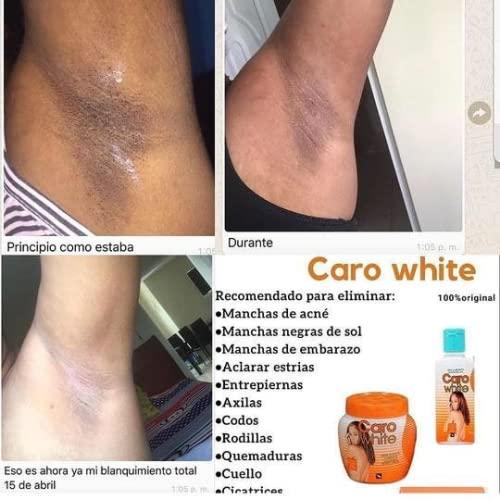 Caro White Caro White Set-3 (Lotion 10.14oz + Cream 10.14oz + Soap 6.3oz)