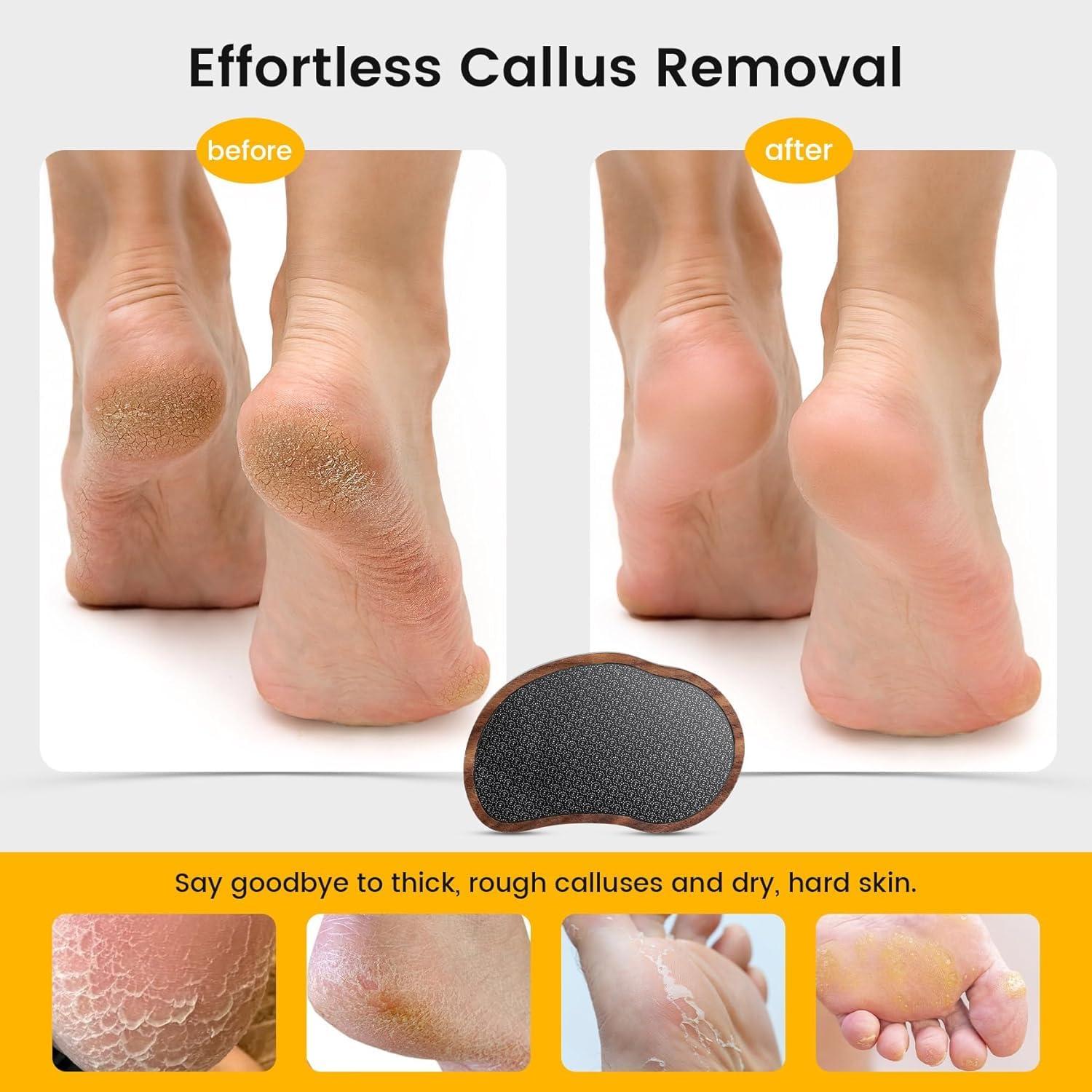 BEZOX BEZOX Glass Foot Scrubber(1 PCS) - Nano-glass Pedi Egg Pumice Stone for Feet Dead Skin, Plastic-Free Pedicure Foot File Callus Remover for Silky Smooth Feet - Walnut Wood Handled