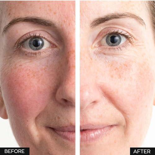 GLOWICTION Anew Protinol Power Serum 7 Signs of Ageing Powerful Results in 7 Days. Smoothes Skin, Reduces Pores and Minimises Lines for Firmer, Stronger, More Resilient, Healthier, Radiant Skin.