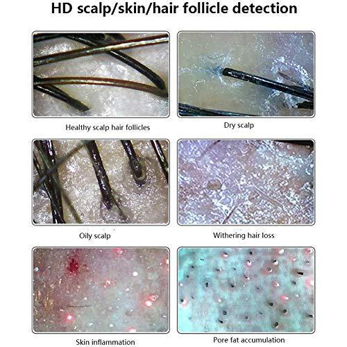 BIUYYY 11-inch Hair Tester, Skin Hair Scalp Detector Digital Microscope Skin Analyser for Skin Hair Care
