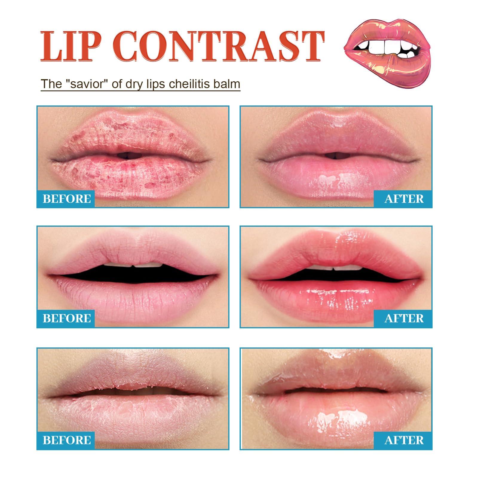 BEROZA Lip Balm, Lip Lightening For Dark Lips, 20g Lip Balm Moisturizing, Lightening balm for Men and Women Moisturizer Essence, Moisturizing Brighten Lip Care Mask (1pcs)