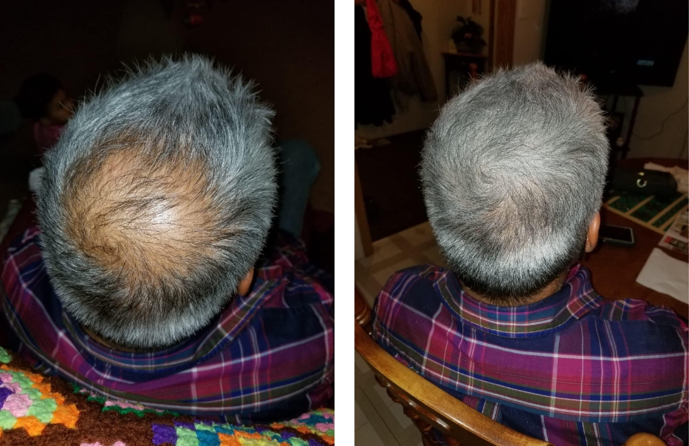 Caboki CABOKI VALUE PACK 1, 2x30G Hair Building Fiber Plus Hair Fiber Spray. 180-Day supply, Salt & Pepper Dark