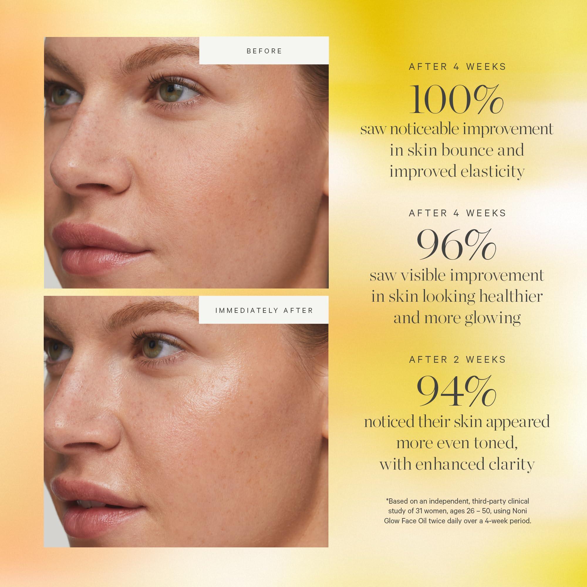 KORA Organics KORA Organics Noni Glow Hydrating Face Oil with Rosehip, Gua Sha Oil, Certified Organic, Cruelty Free, 1.01 fl oz