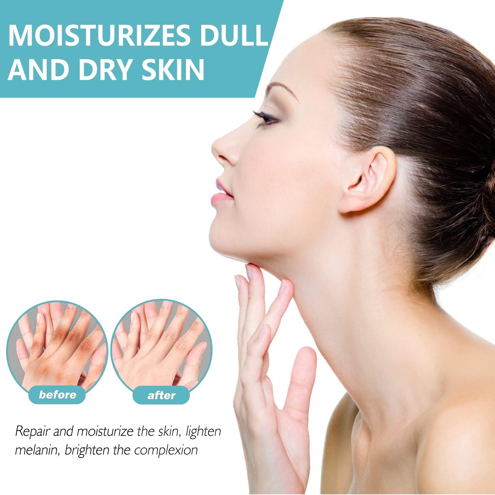 Nigrifix Nigrifix Acanthosis Nigricans Therapy Cream,Dark Spot Remover For Body,Dark Spot Corrector Cream,- Underarm, Neck, Armpit, Knees, Elbows, Private Areas, Intimate Areas - Upgraded Formula, 2.1Fl Oz