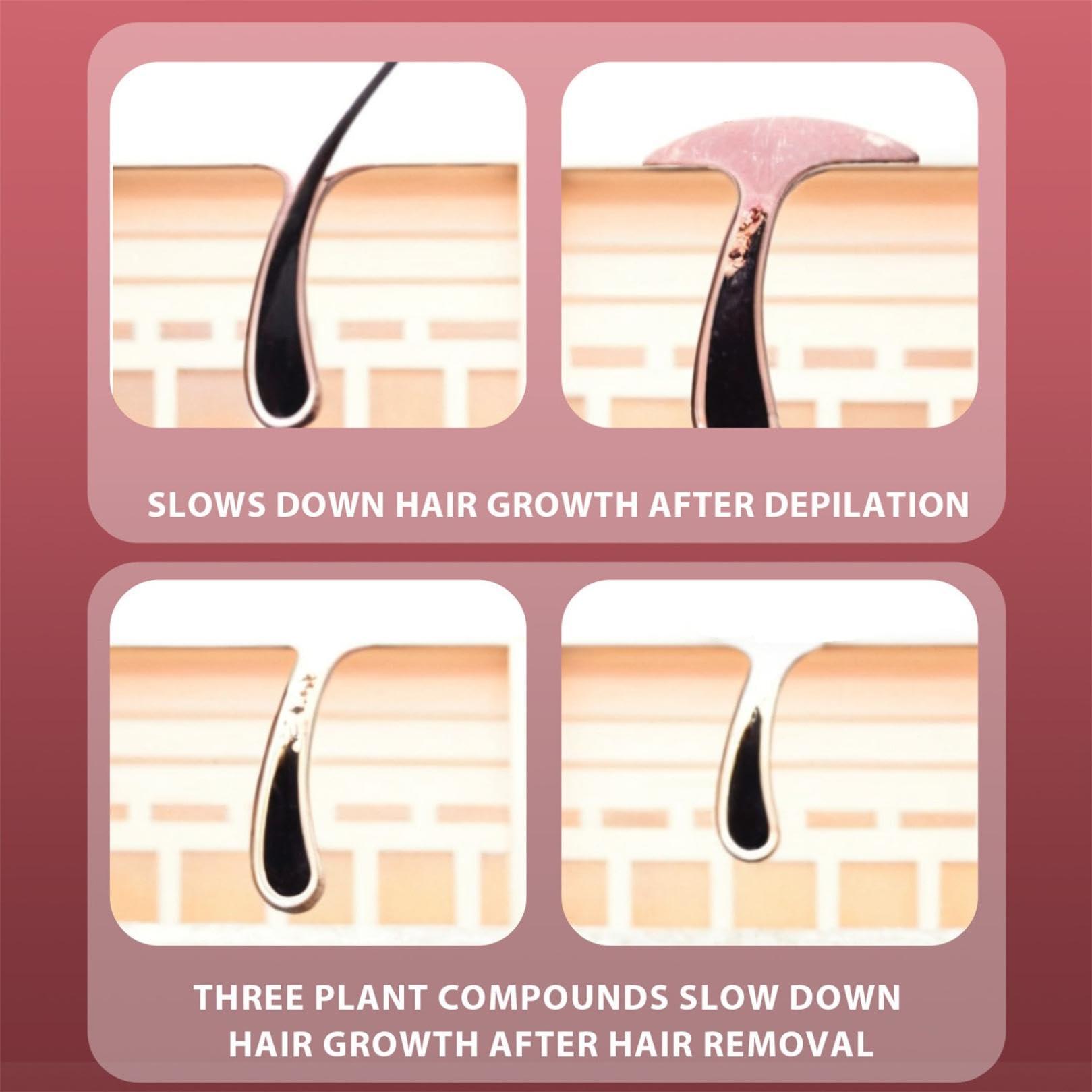 NinthAvenue Basics Intimate Hair Removal Cream: Women and Men Home Use - Whole Body Bikini Line Face Leg Underarm Area Depilatory (1)