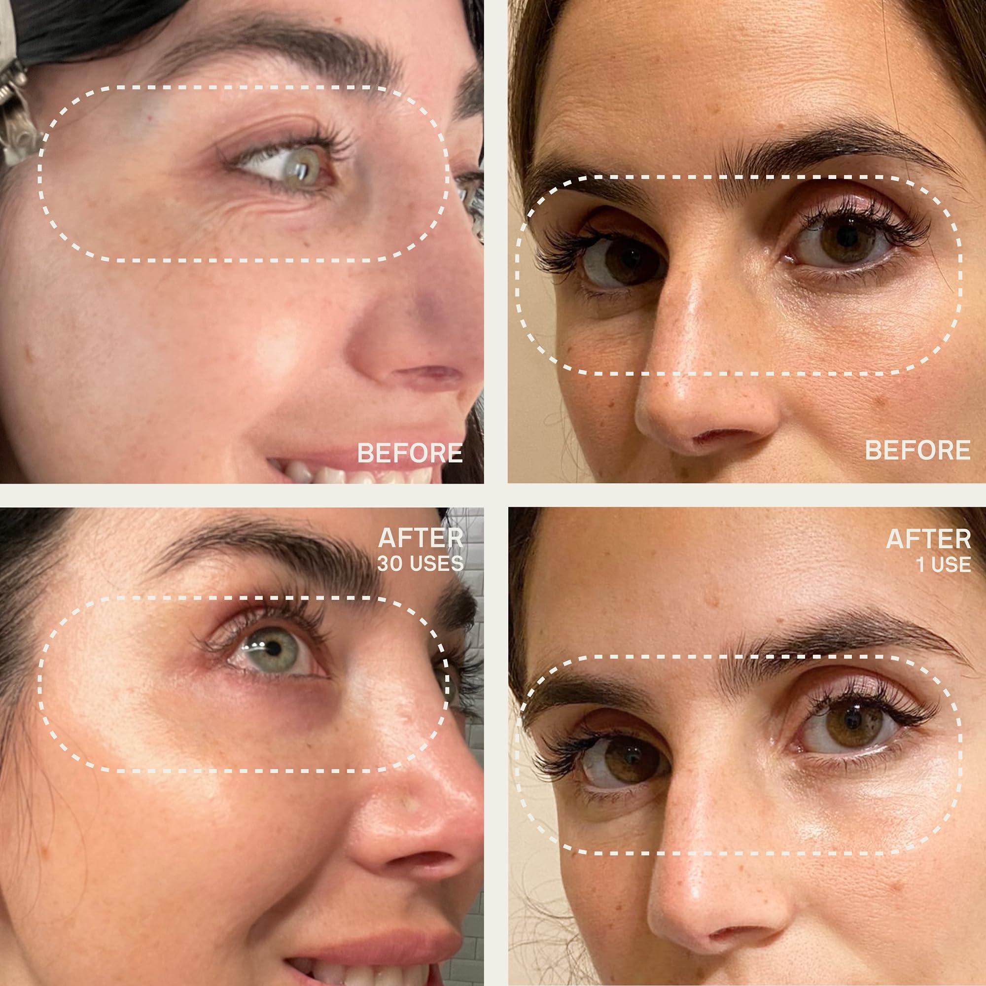 Dermaclara Dermaclara Face Patches Kit - Anti Wrinkle Patches for Forehead, Smile Lines, Silicone Anti-Wrinkle Frown Line Treatment, Up to 30 Uses - 1 Forehead, 2 Mouth, 2 Eye, 1 Neck & 1 Patch Prep Cleanser