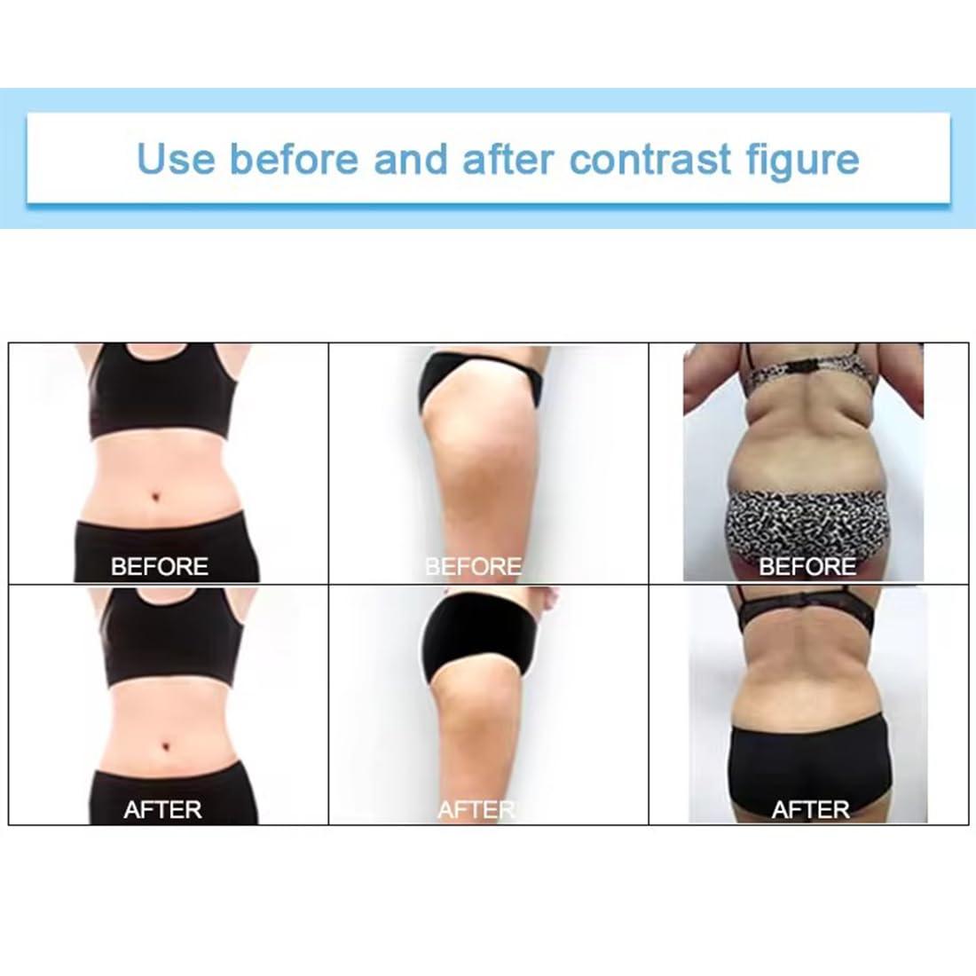 MTHAT lipo light machine Body Arm Leg Use for home Use or Salon (U.S. Warehouse Shipping)