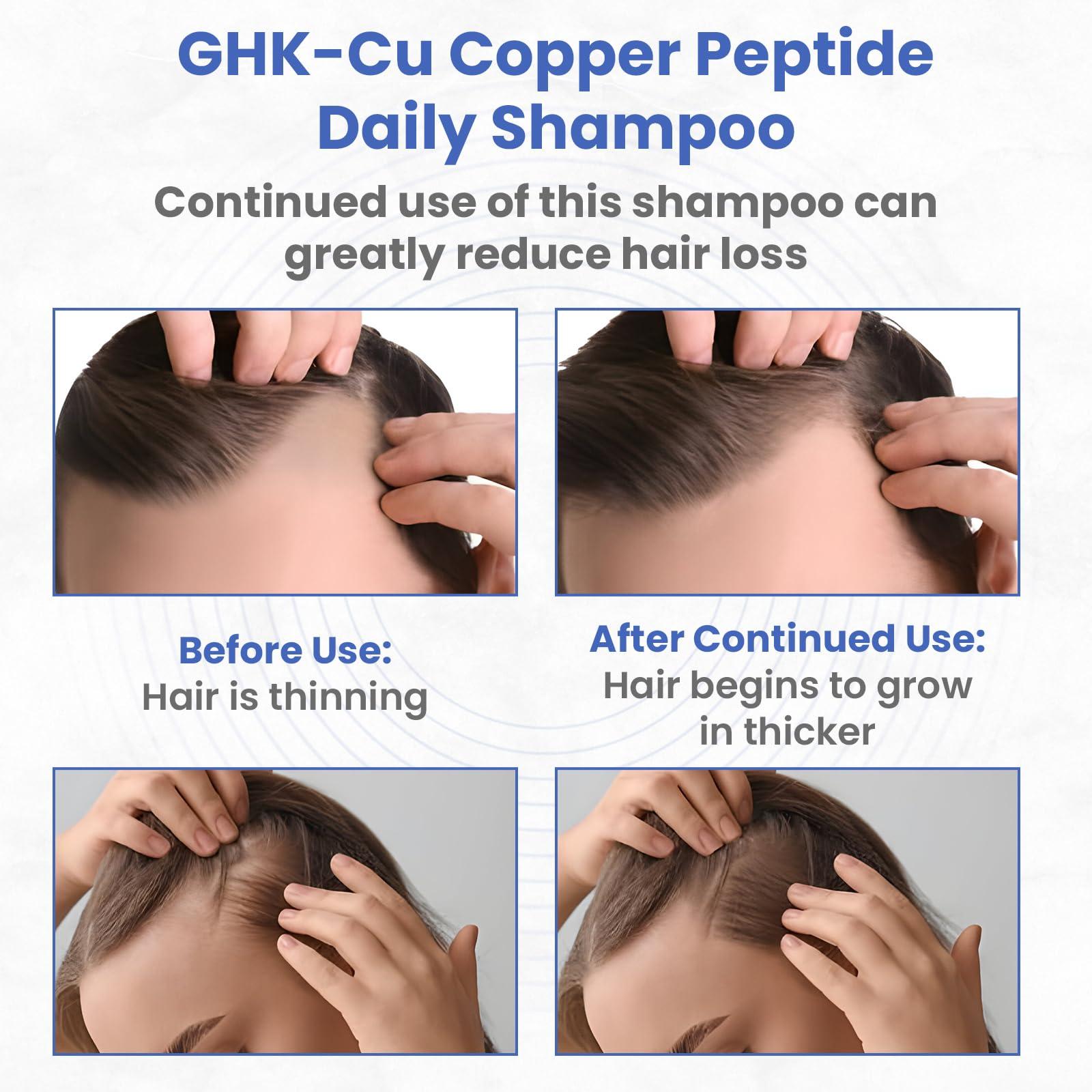 PeptideLabz Copper Peptide Shampoo - Anti Hair Loss Shampoo - Promotes New Hair Growth