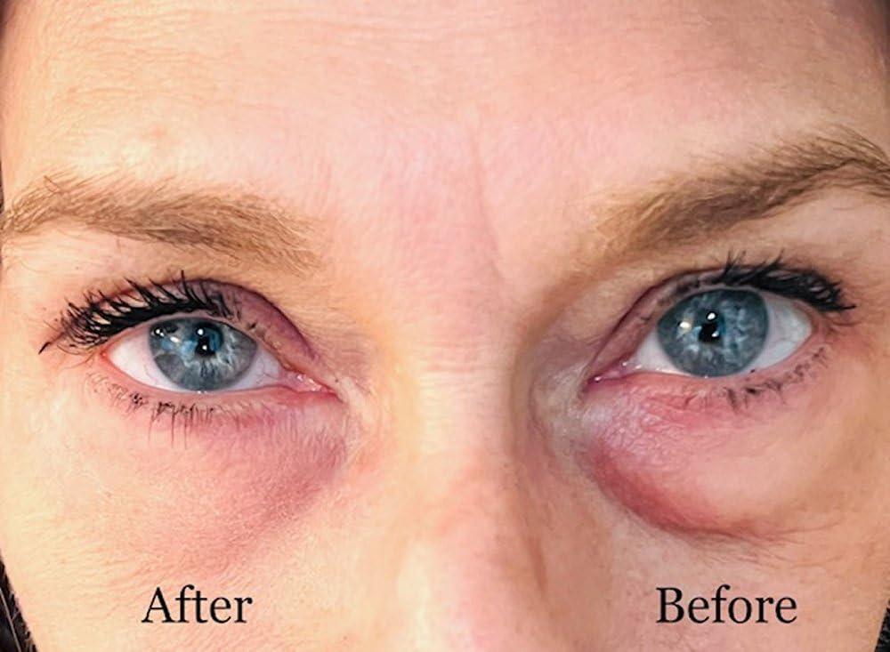 Generic Instant Eye Bag Puffiness And Wrinkle Remover Cream For Women And Men Made In The USA! Cruelty-Free